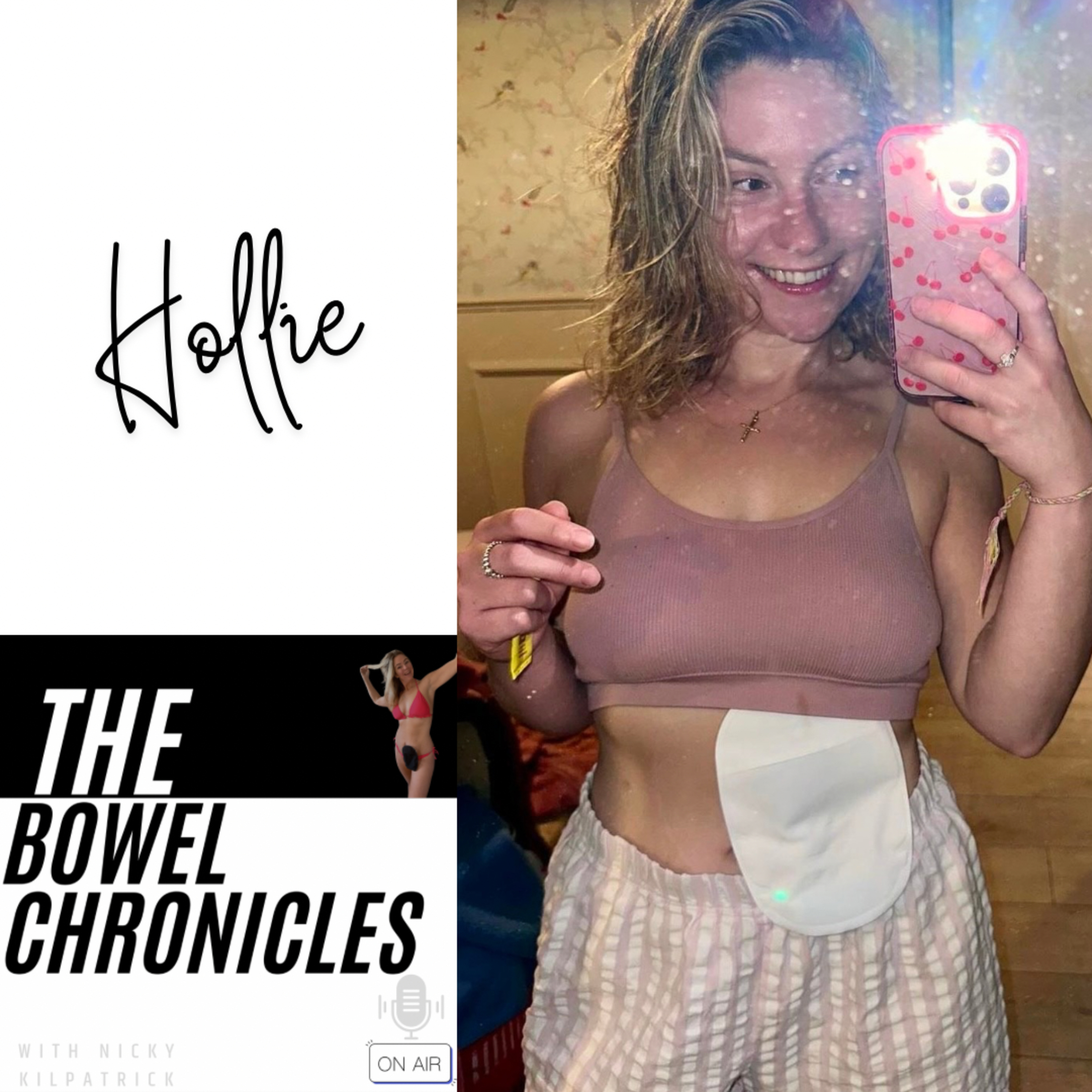 The Bowel Chronicles