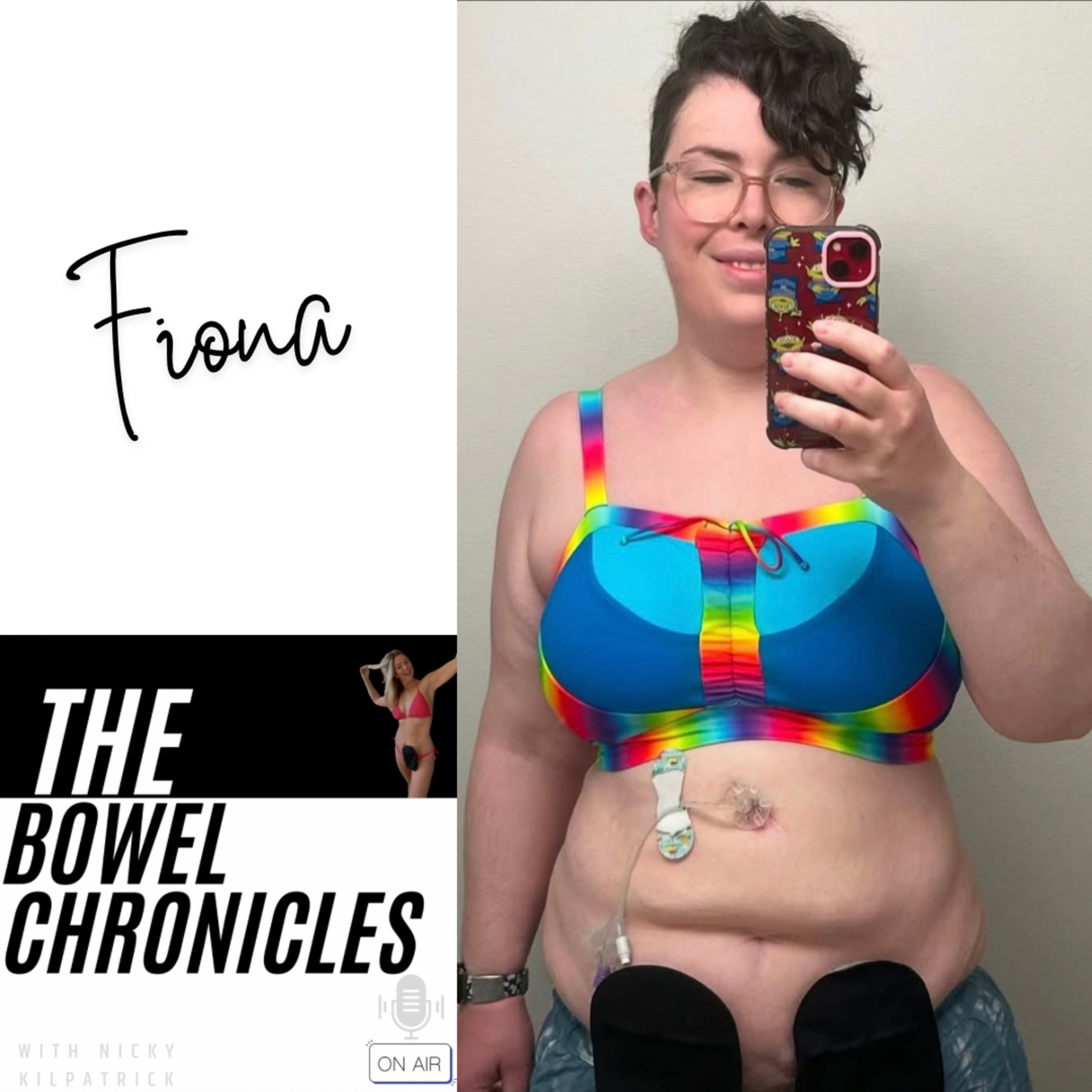 The Bowel Chronicles