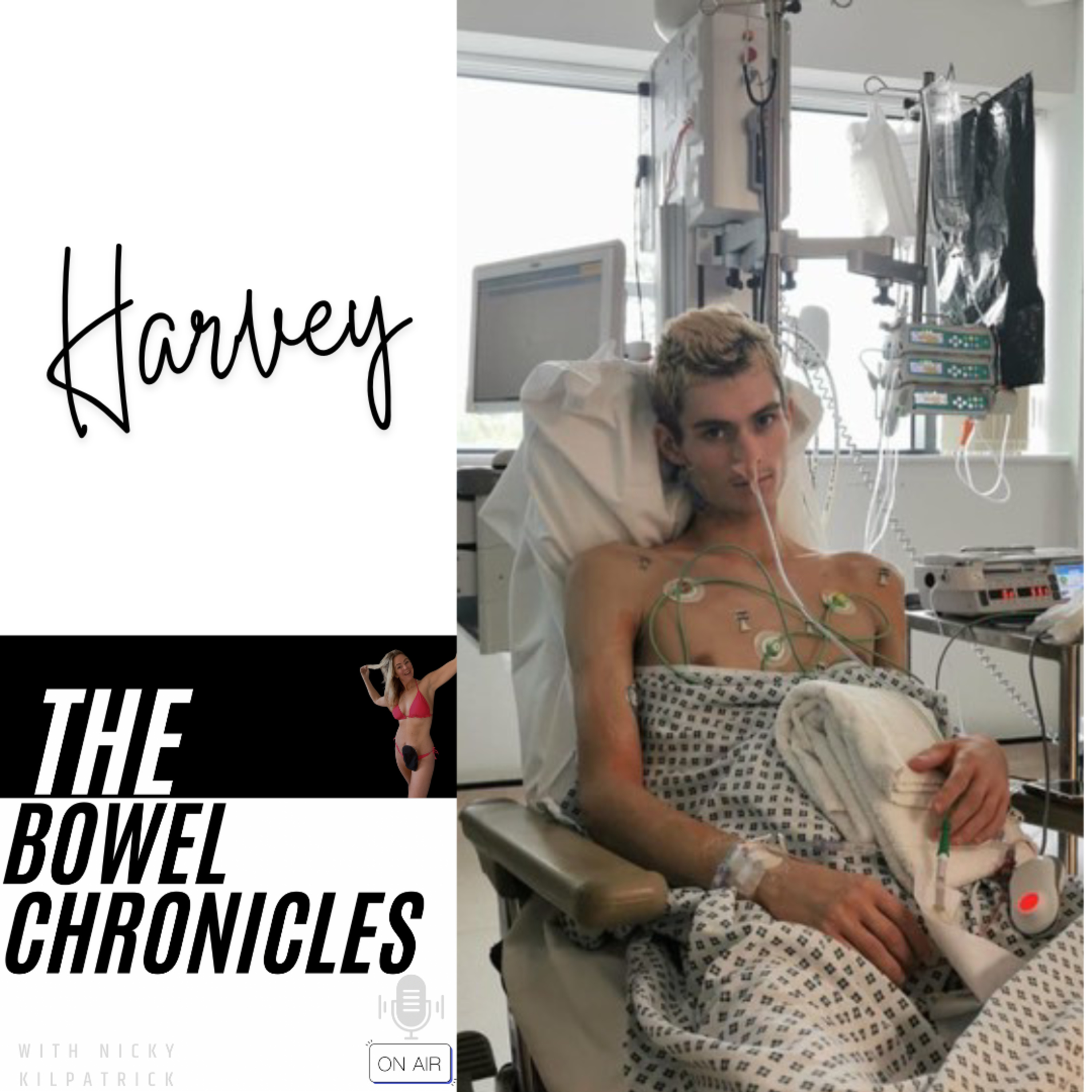 The Bowel Chronicles