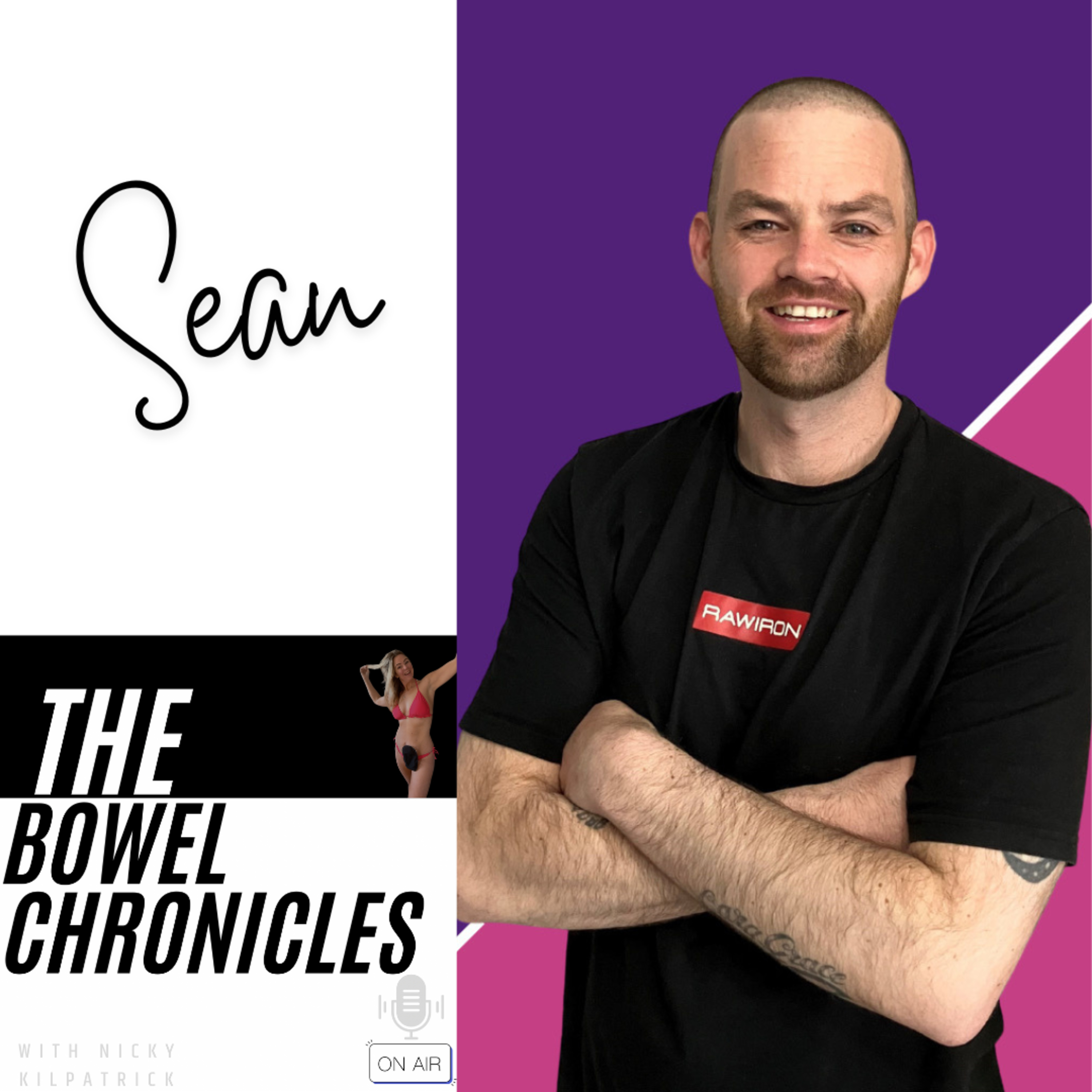 The Bowel Chronicles