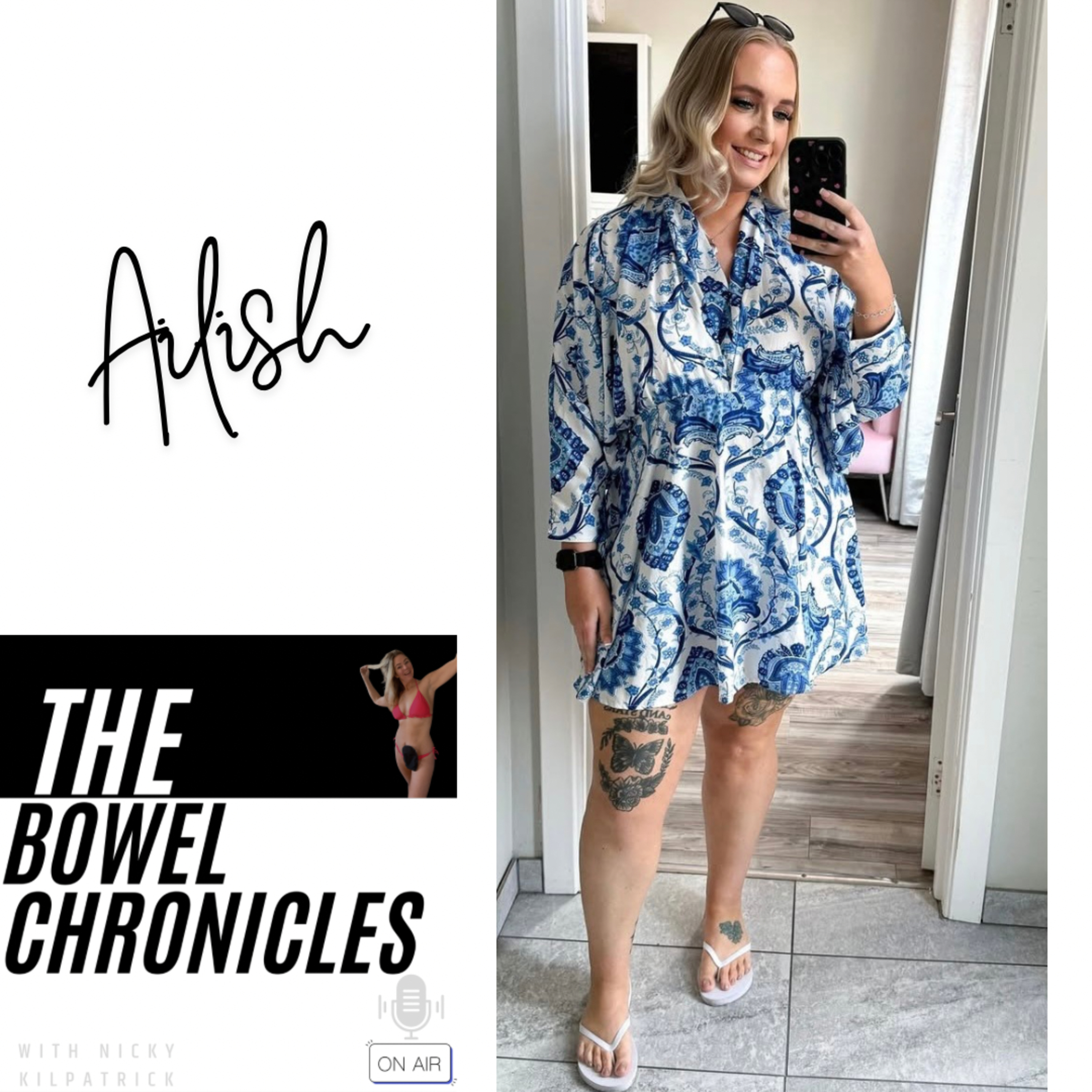 The Bowel Chronicles