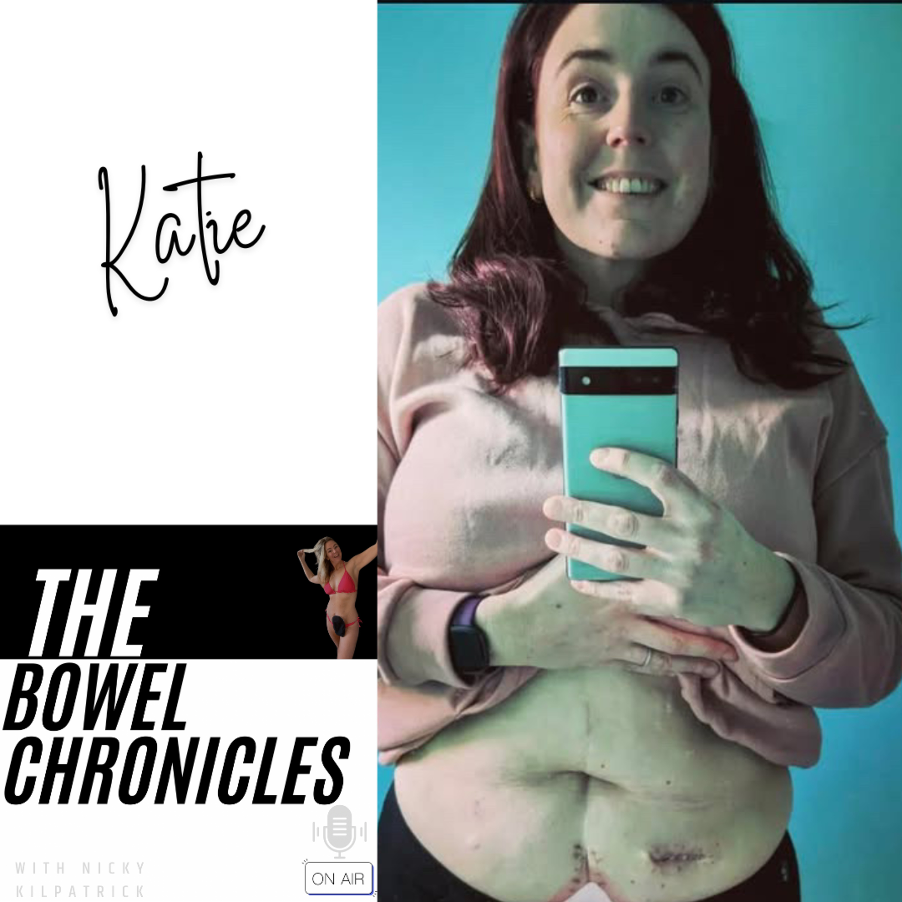 The Bowel Chronicles