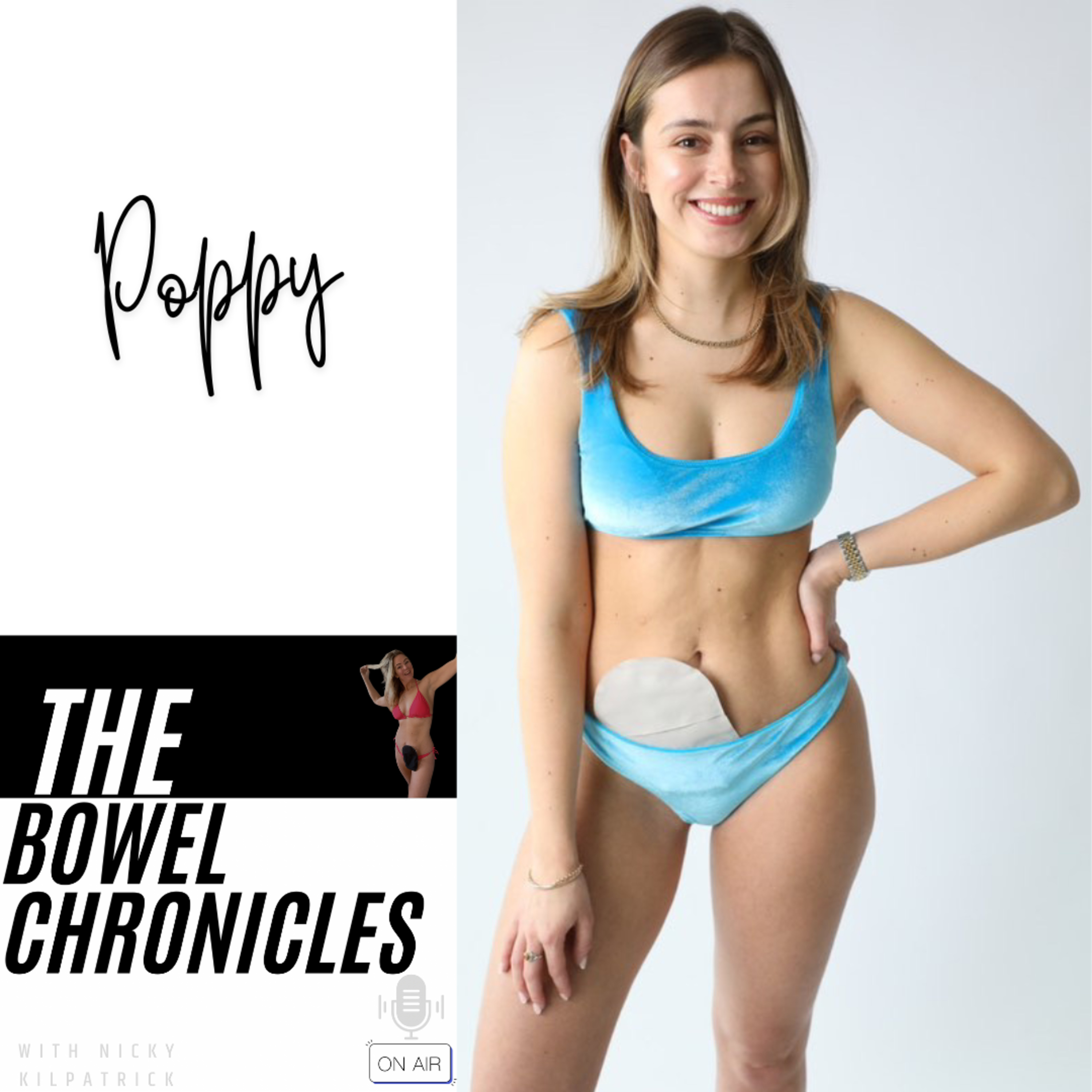 The Bowel Chronicles