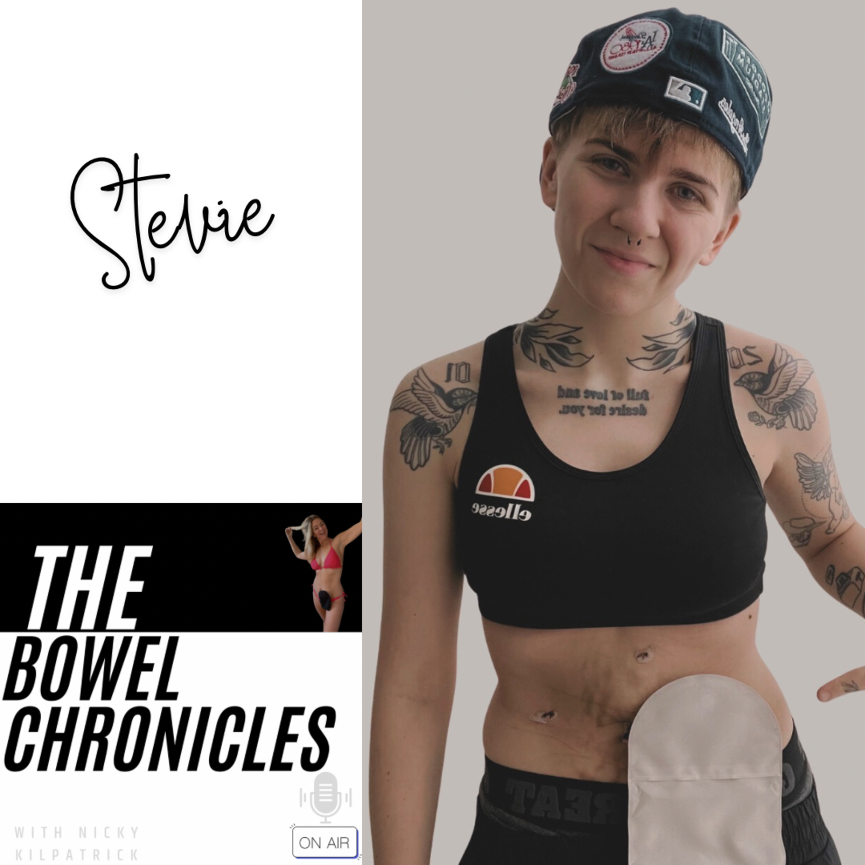 The Bowel Chronicles