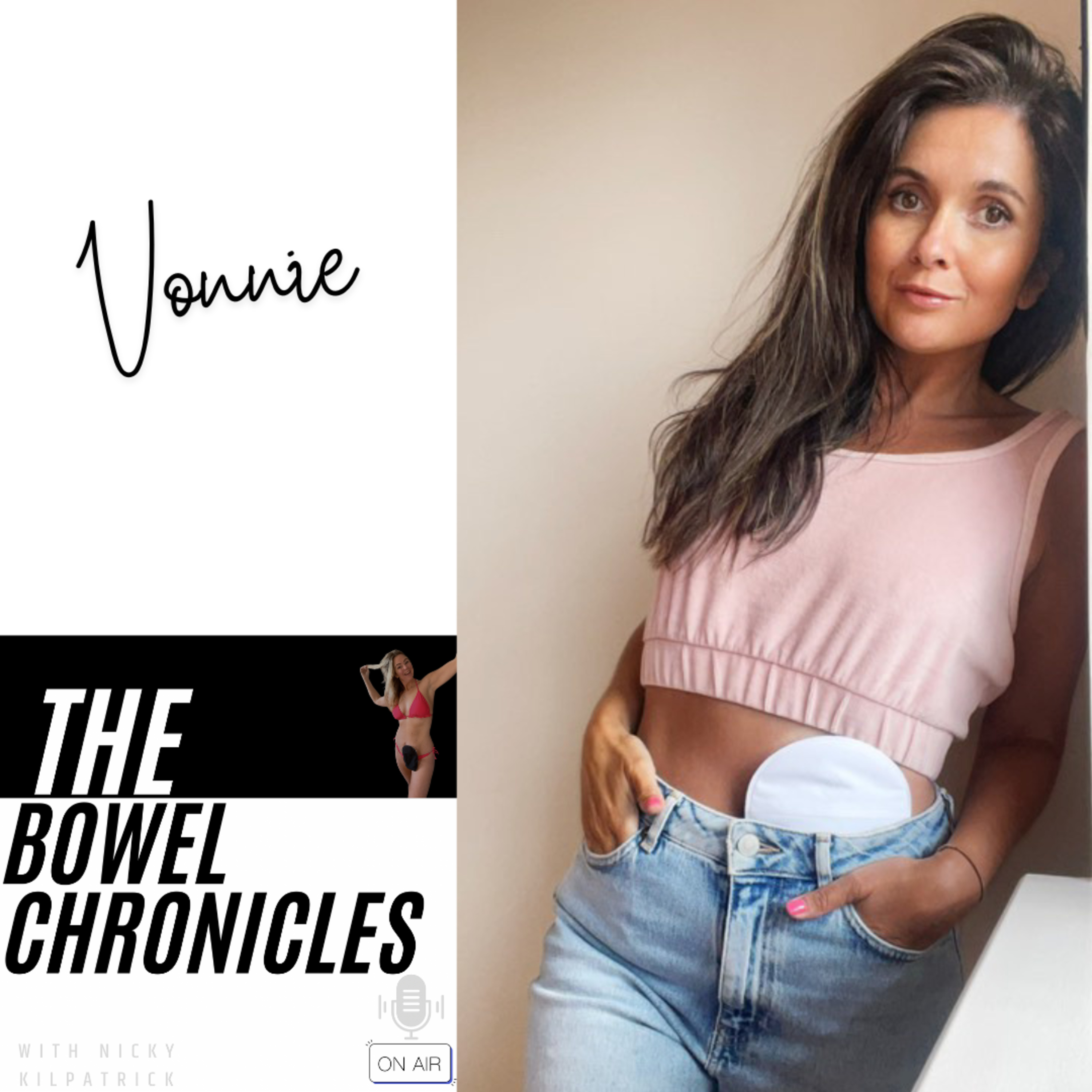 The Bowel Chronicles