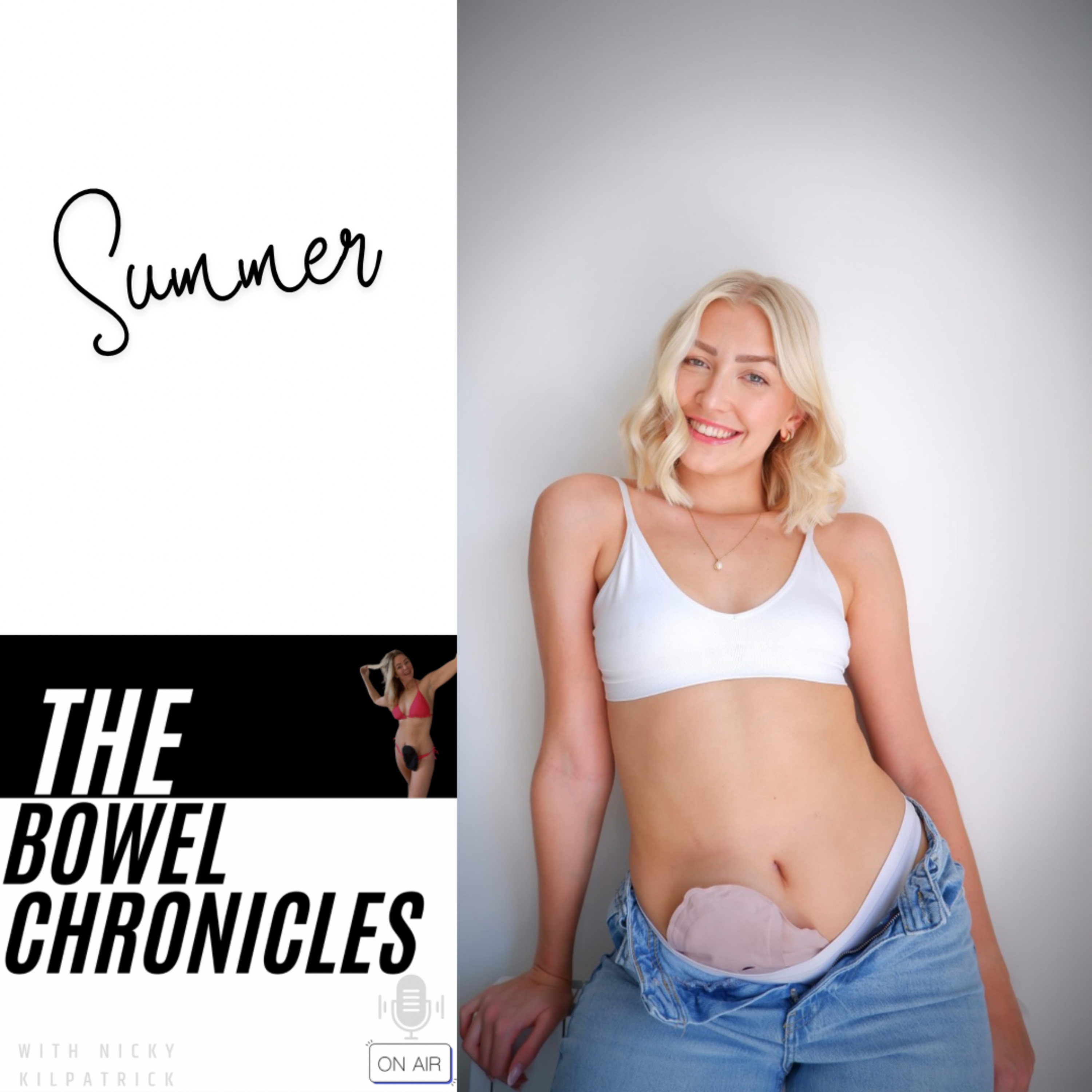 The Bowel Chronicles