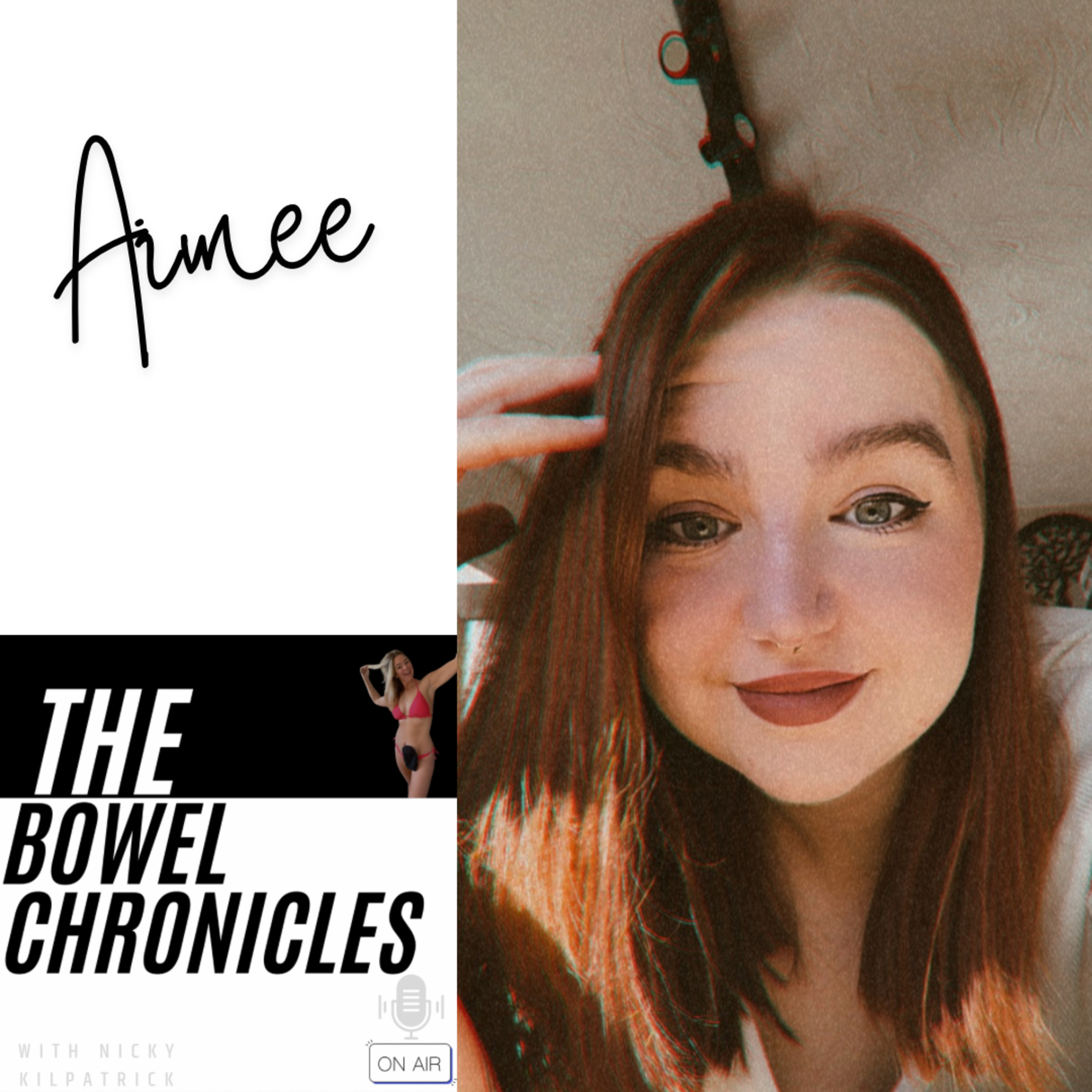 The Bowel Chronicles