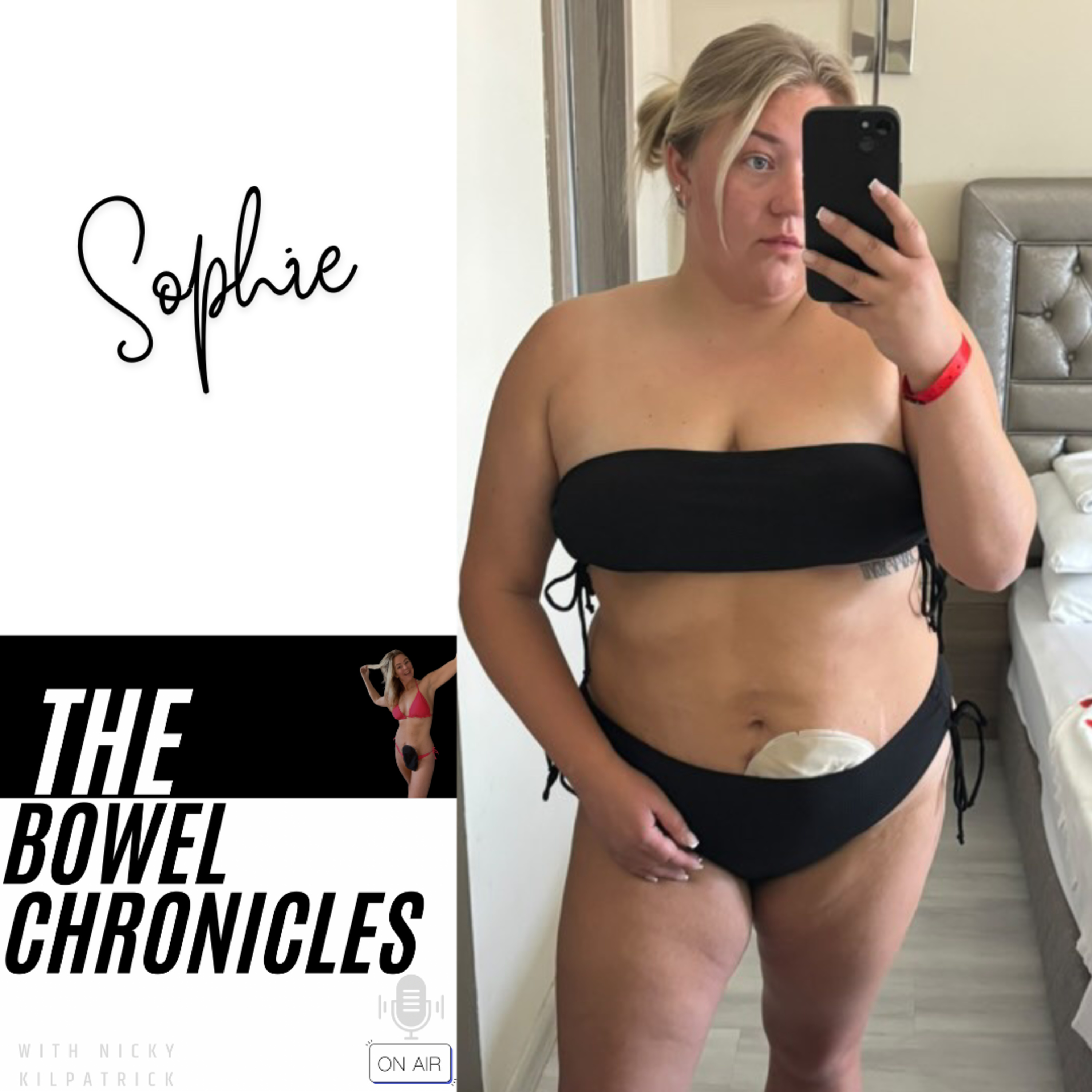 The Bowel Chronicles