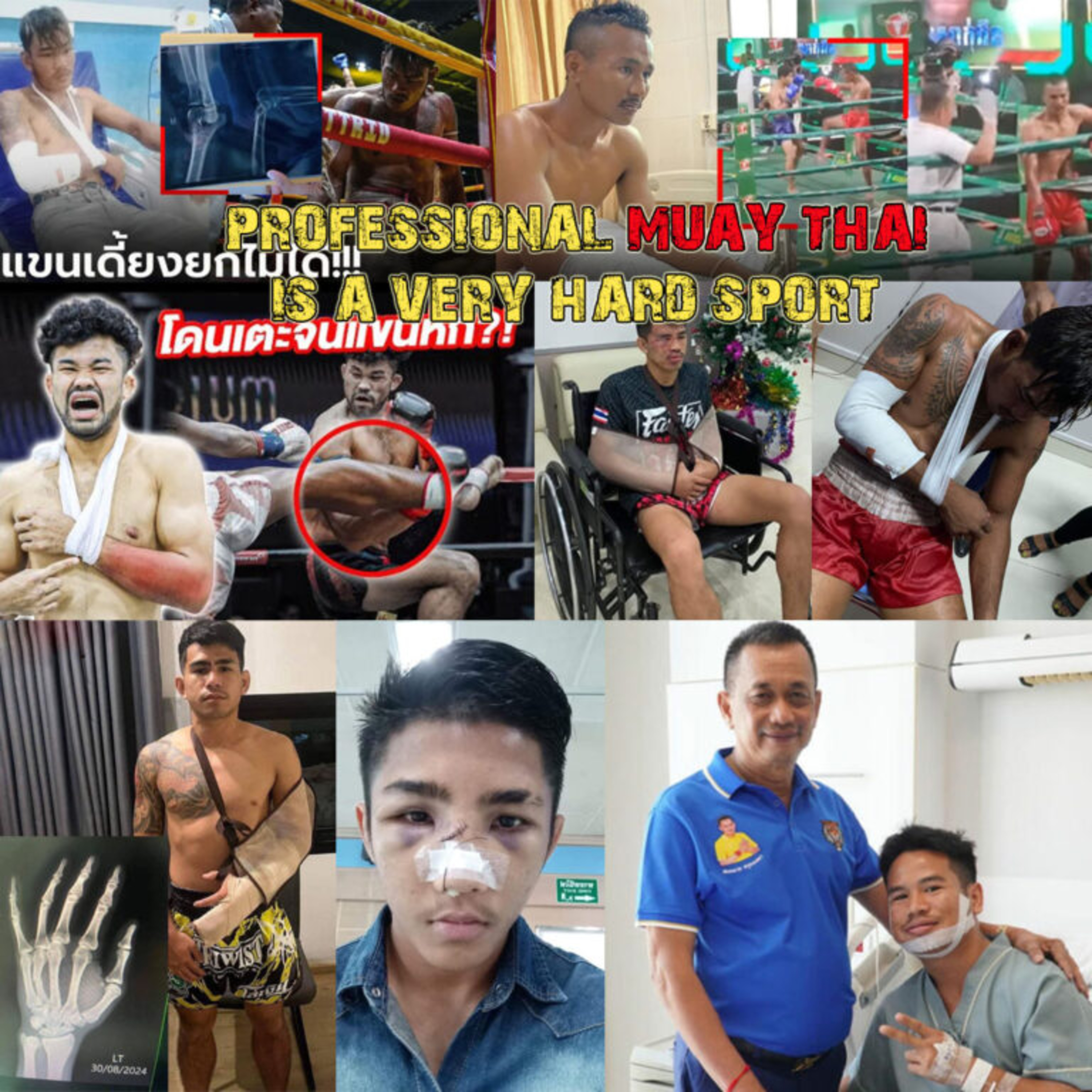 Le Muay Thai professionnel est un sport très dur