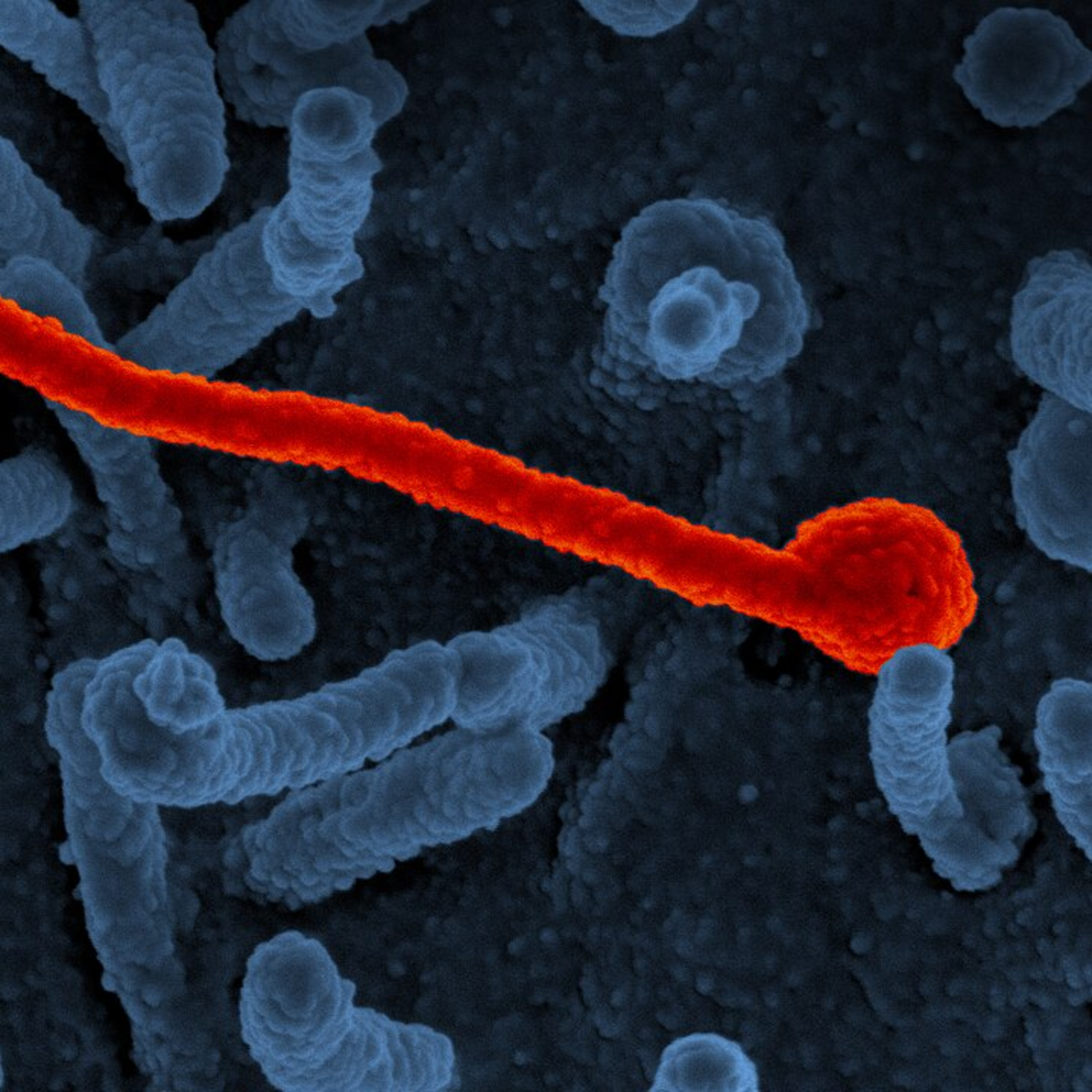 Ebola, ptačí chřipka, hantavirus, Marburg. Pomůže AI předejít příští pandemii, nebo ji způsobí?