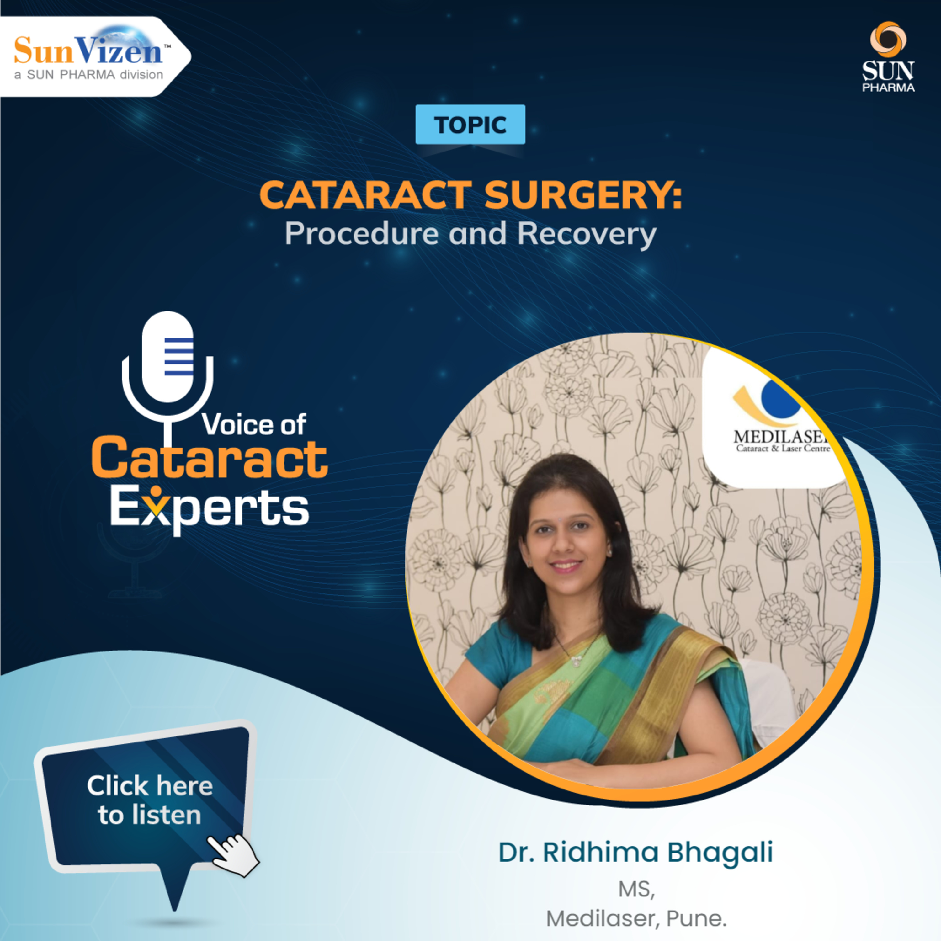 Voice of Cataract Experts