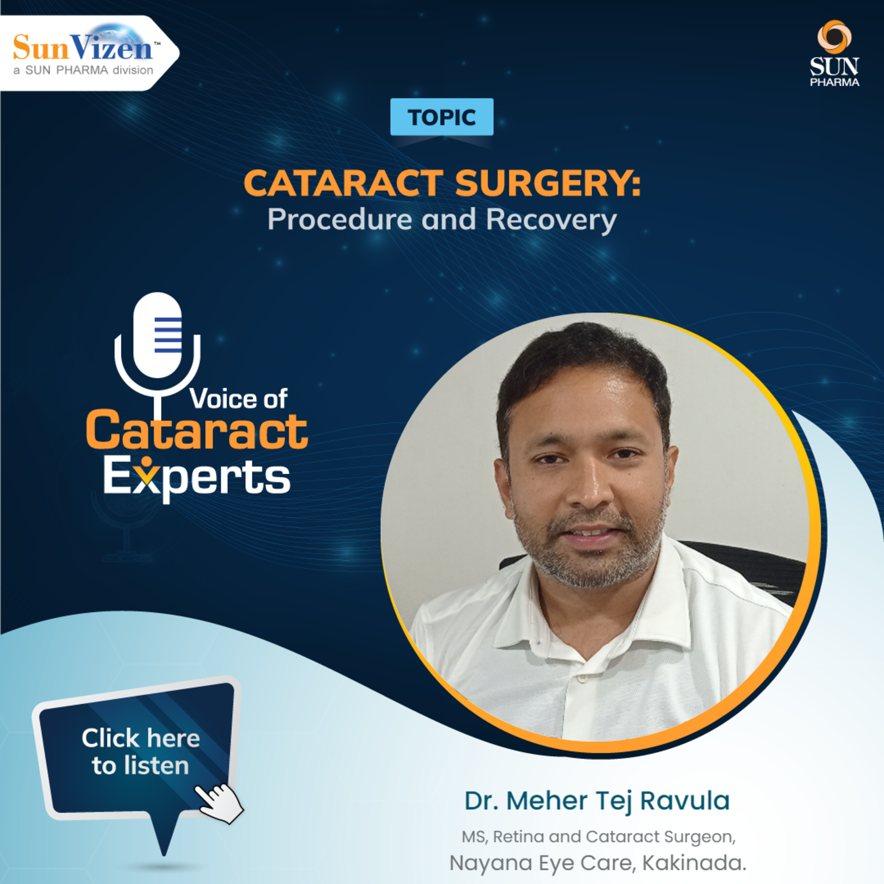 Voice of Cataract Experts