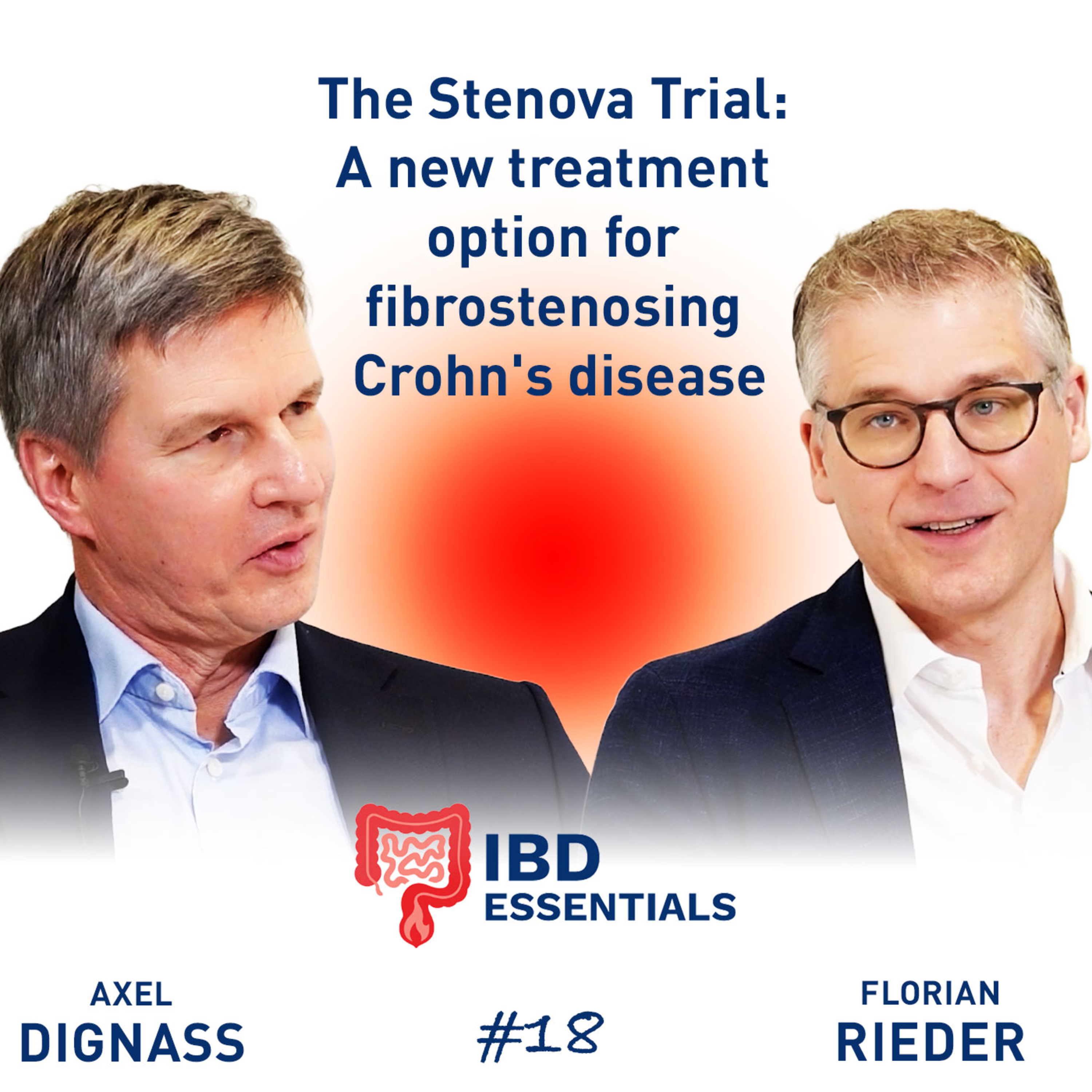 The Stenova trial: A new treatment option with Ontunisertib in fibrostenosing CD episode artwork