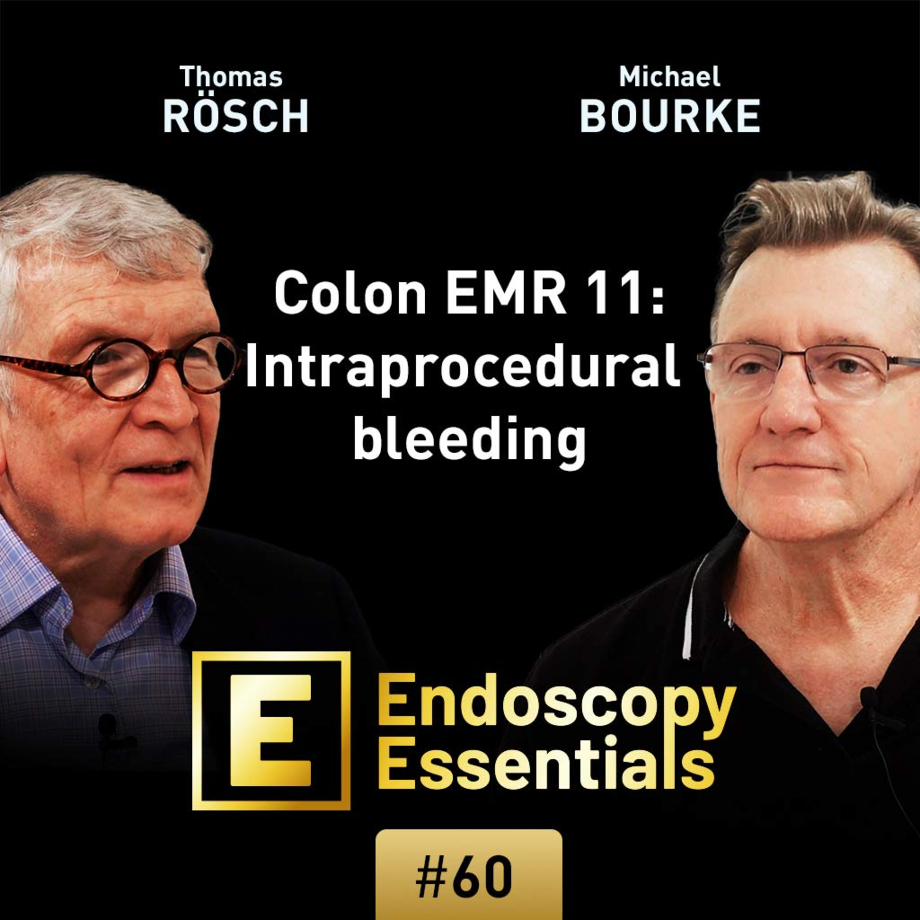 Intraprocedural bleeding during colonic EMR with Michael Bourke episode artwork