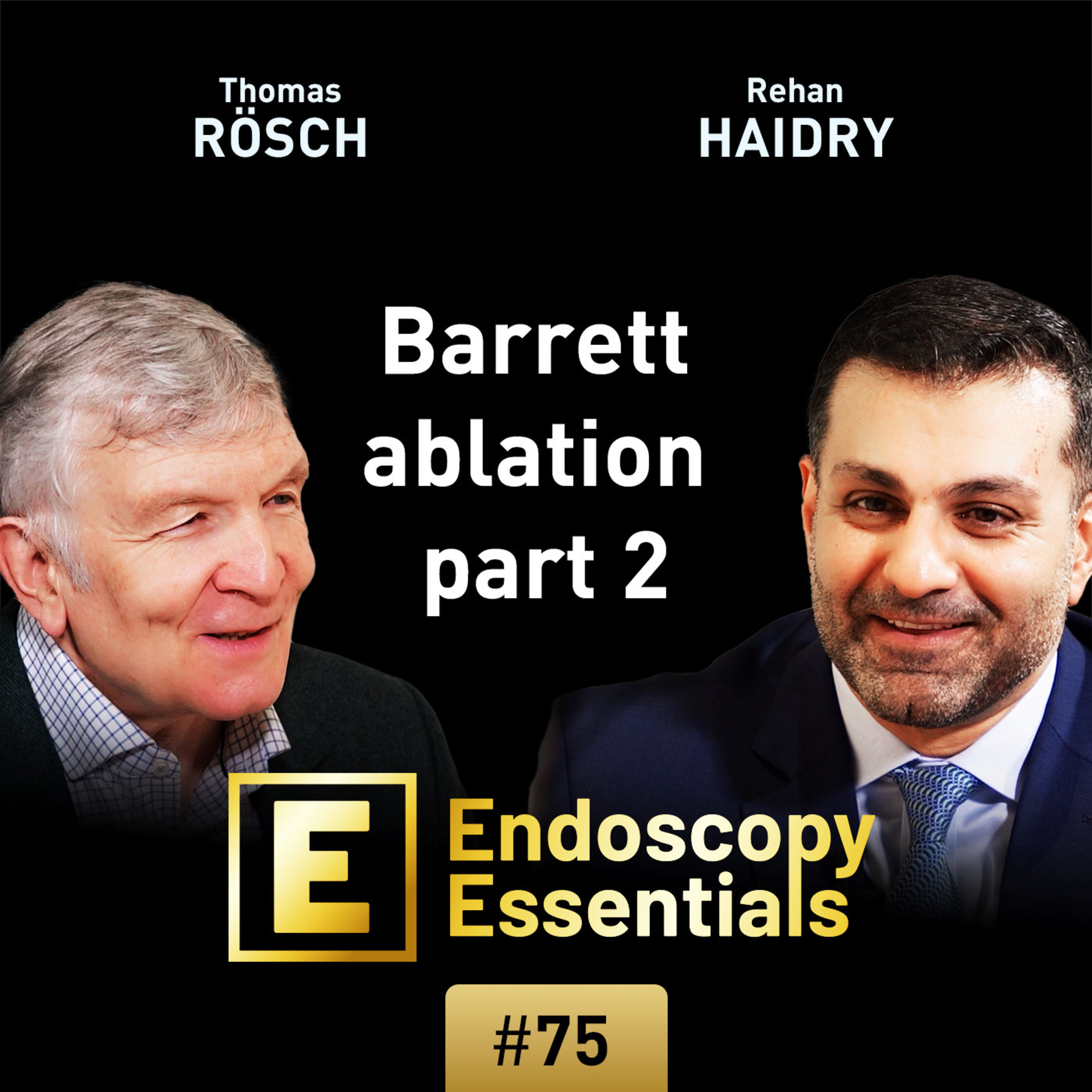 RFA in Barretts esophagus: Performance and follow-up episode artwork