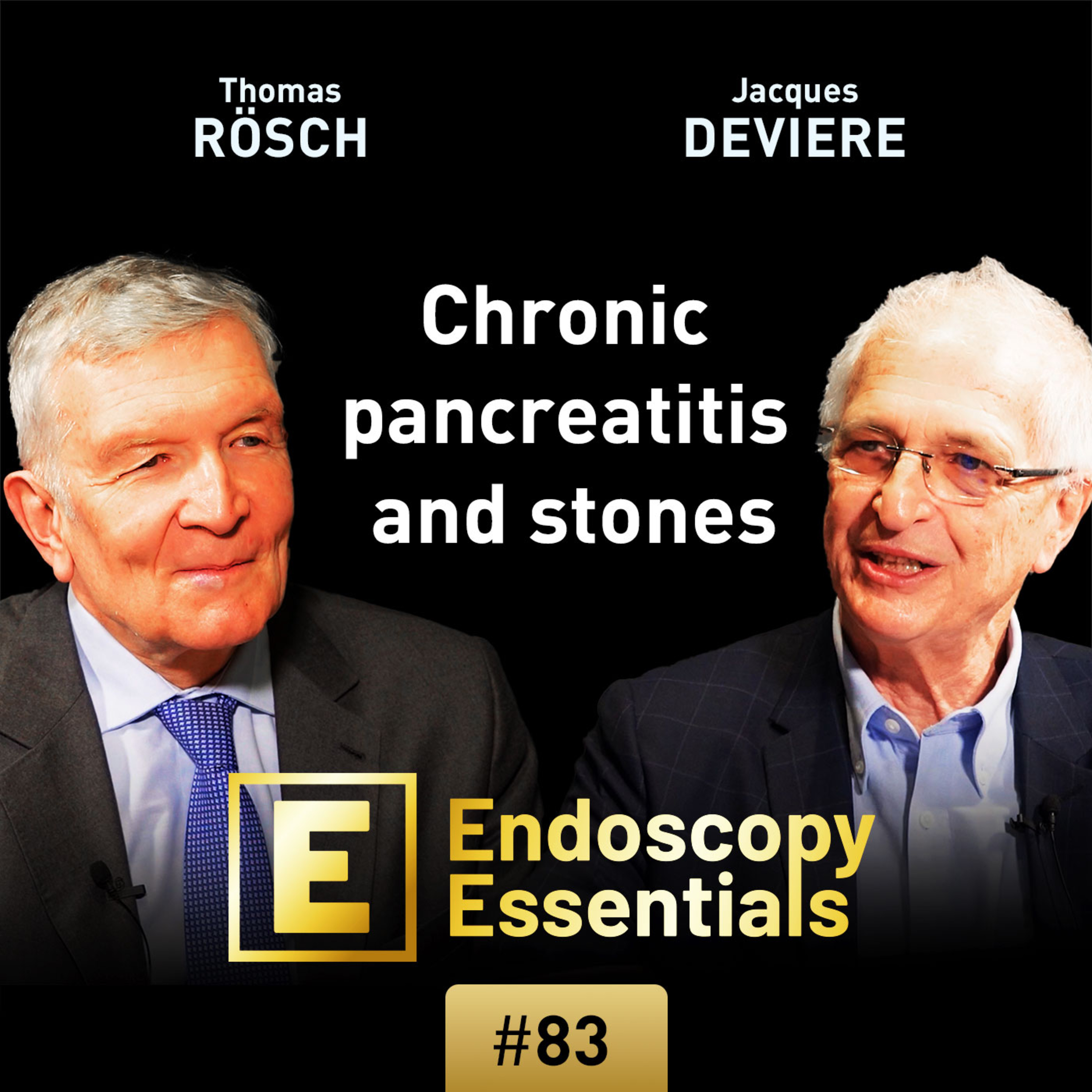 Endostherapy of pancreatic duct stones episode artwork