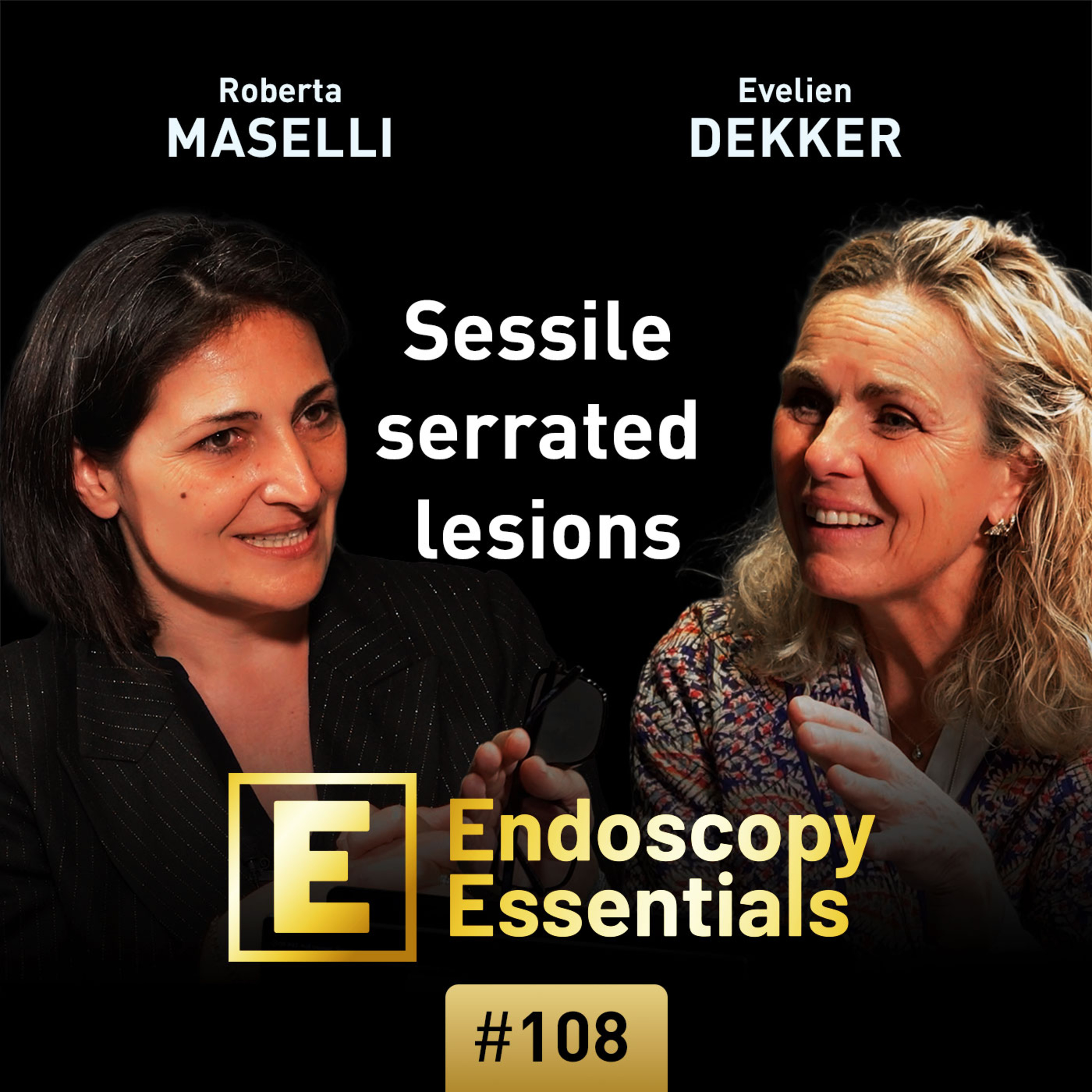 Colonic sessile serrated lesions episode artwork
