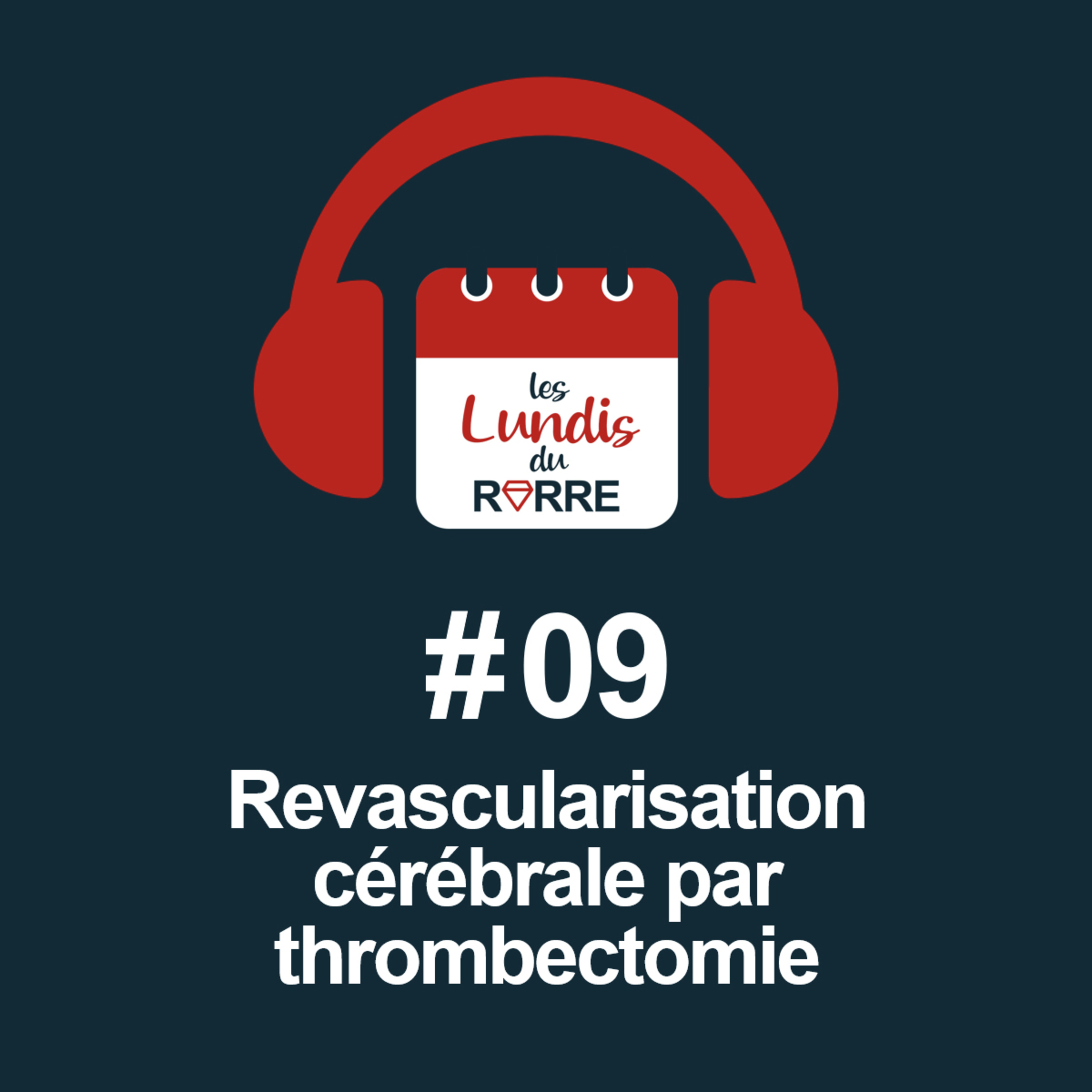 #09. Revascularisation cérébrale par thrombectomie episode artwork