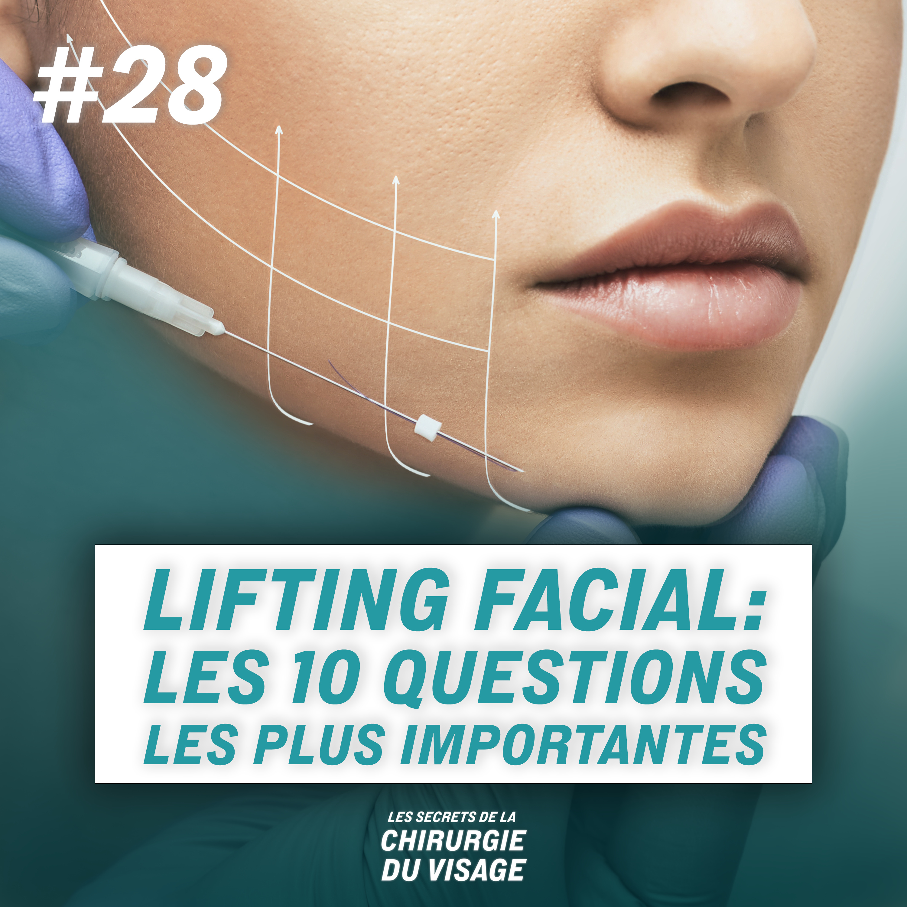 #28 - LIFTING FACIAL : LES 10 QUESTIONS LES PLUS IMPORTANTES. episode artwork