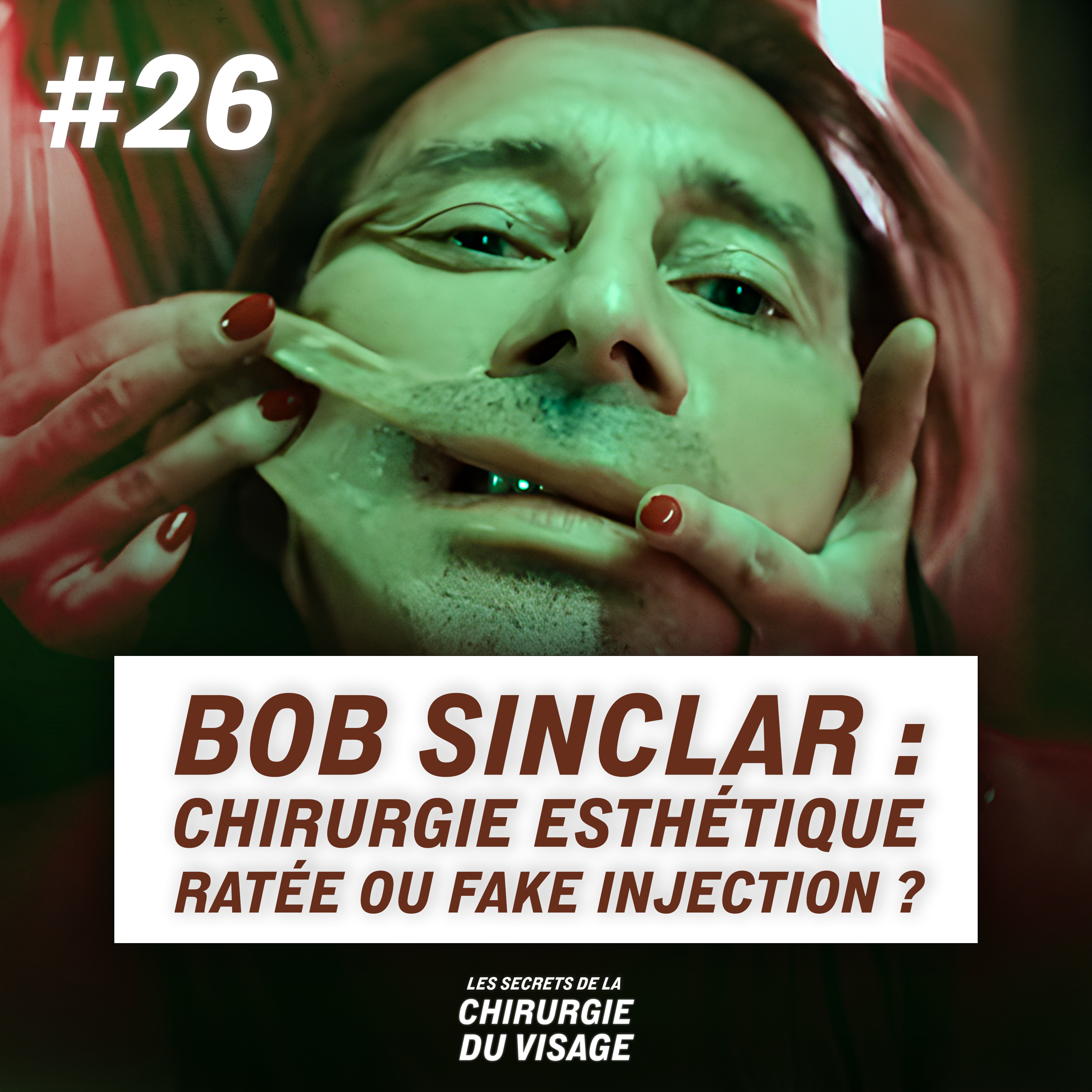 #26 - BOB SINCLAR : CHIRURGIE ESTHÉTIQUE RATÉE OU FAKE INJECTION ? episode artwork