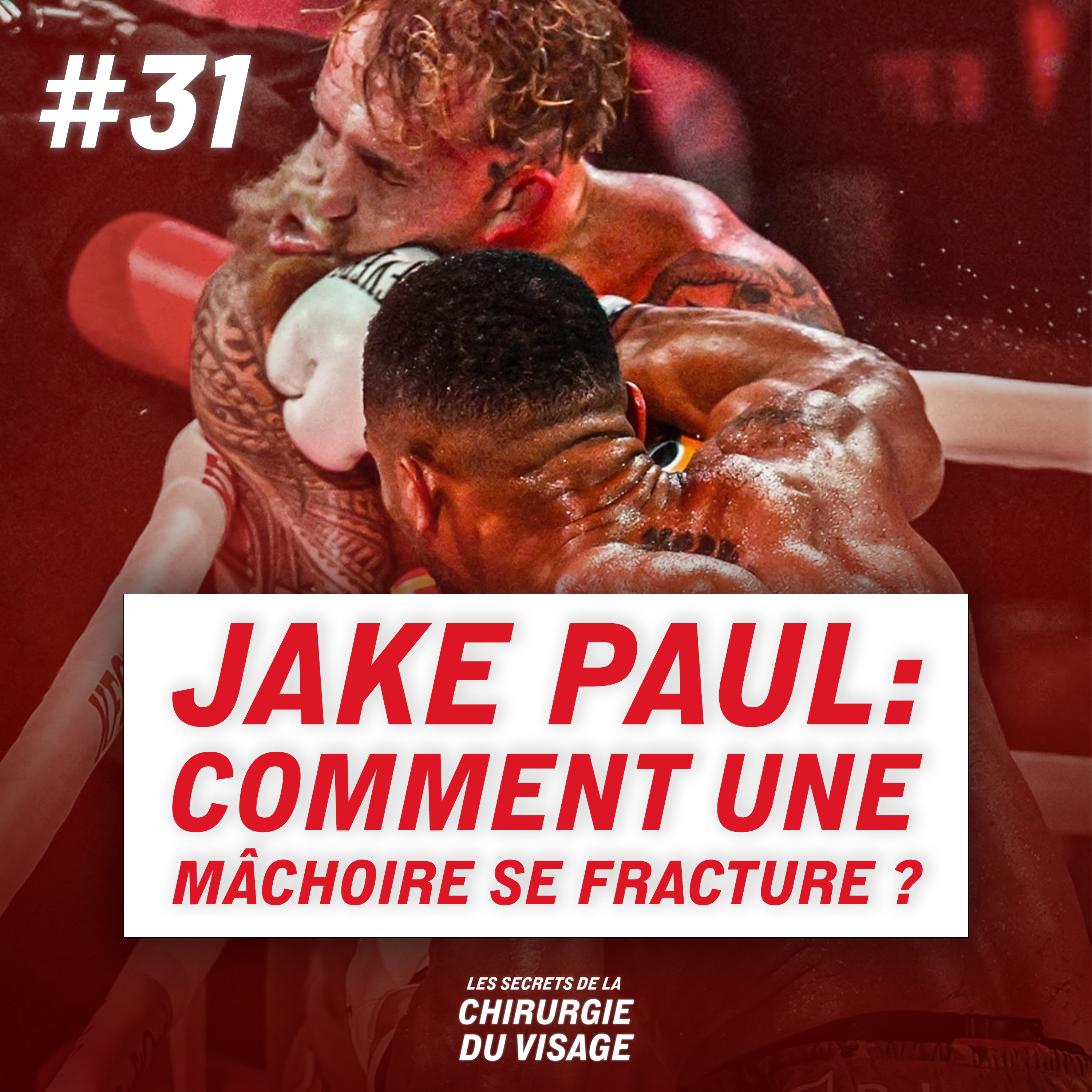 #31 - JAKE PAUL : COMMENT UNE MÂCHOIRE SE FRACTURE ? episode artwork