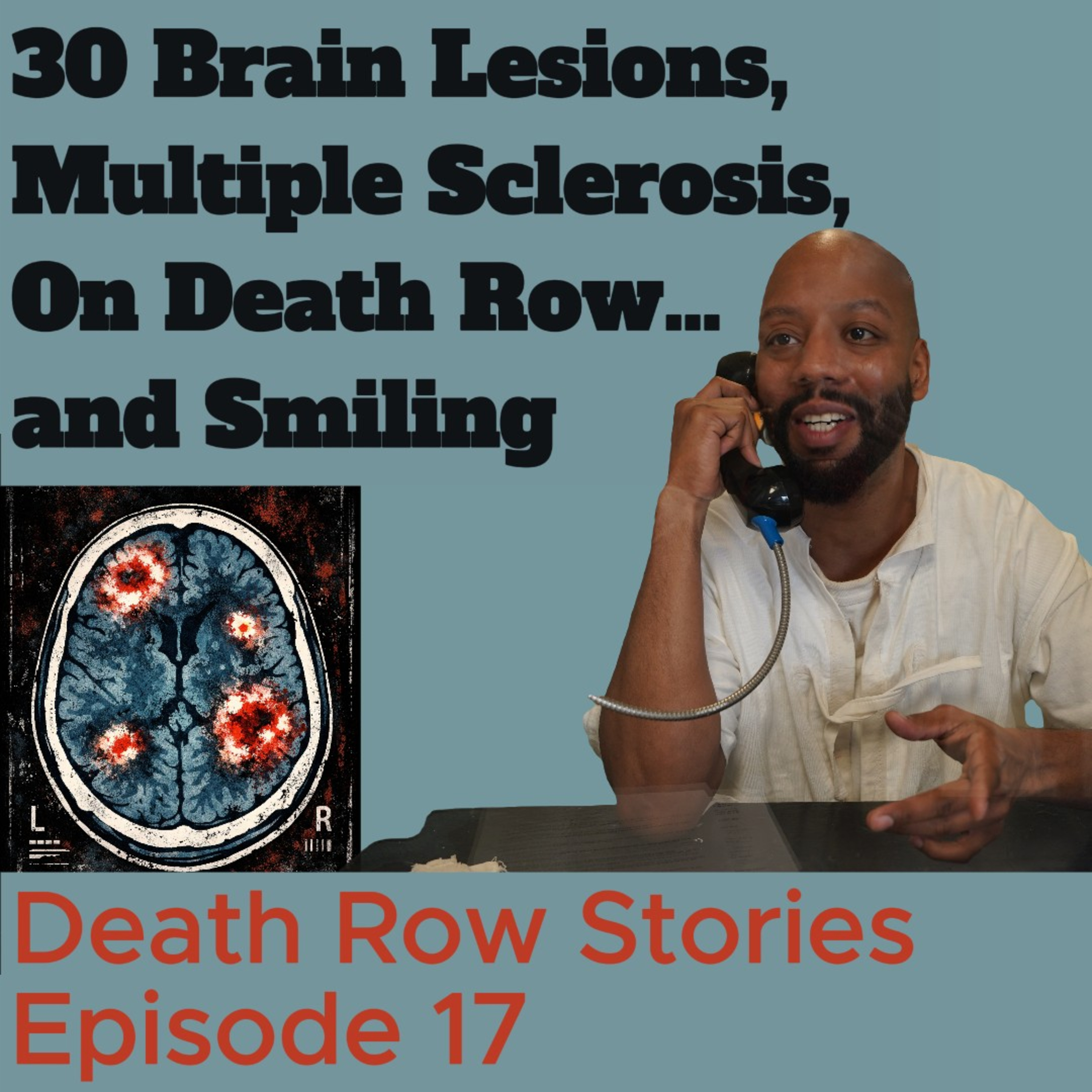 30 Brain Lesions, Multiple Sclerosis, On Death Row… and Smiling (with names withdrawed) episode artwork