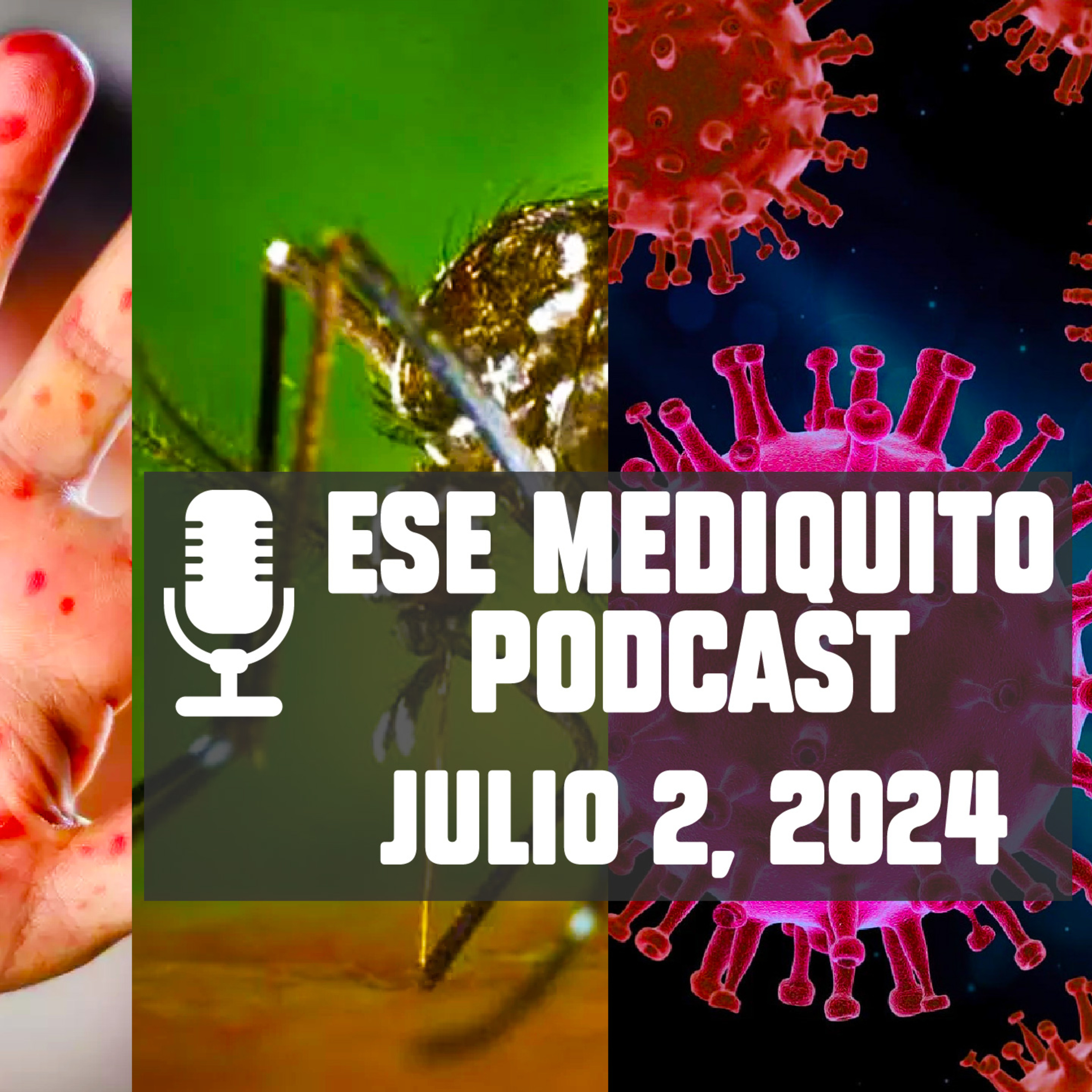Brotes de SARAMPIÓN - Vacuna contra el CHIKUNGUNYA | Variante KP.3 | Julio 2 , 2024 - Podcast #3 episode artwork