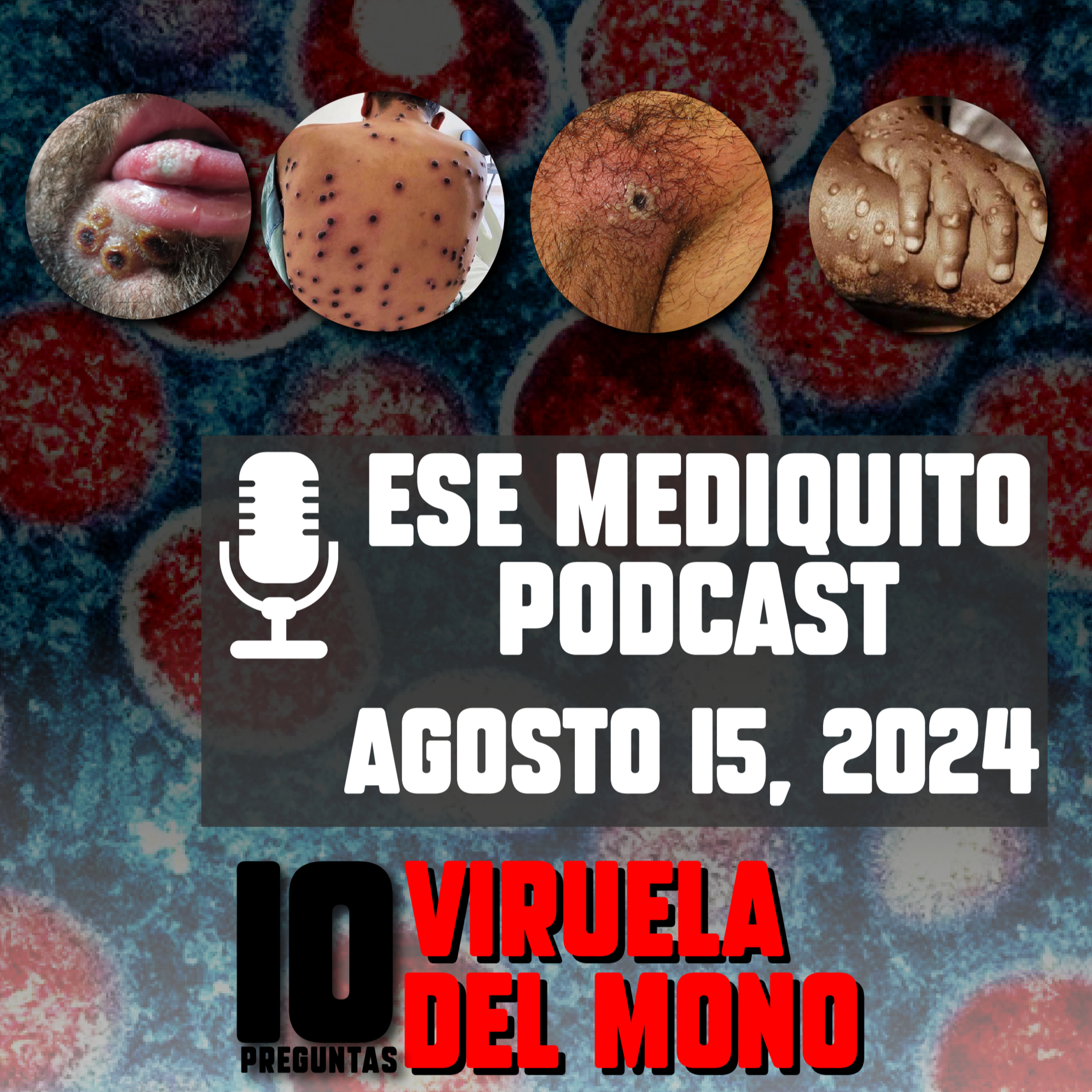 EMERGENCIA MUNDIAL: 10 Preguntas y Respuestas sobre la VIRUELA SÍMICA / VIRUELA DEL MONO #mpox | E35 episode artwork