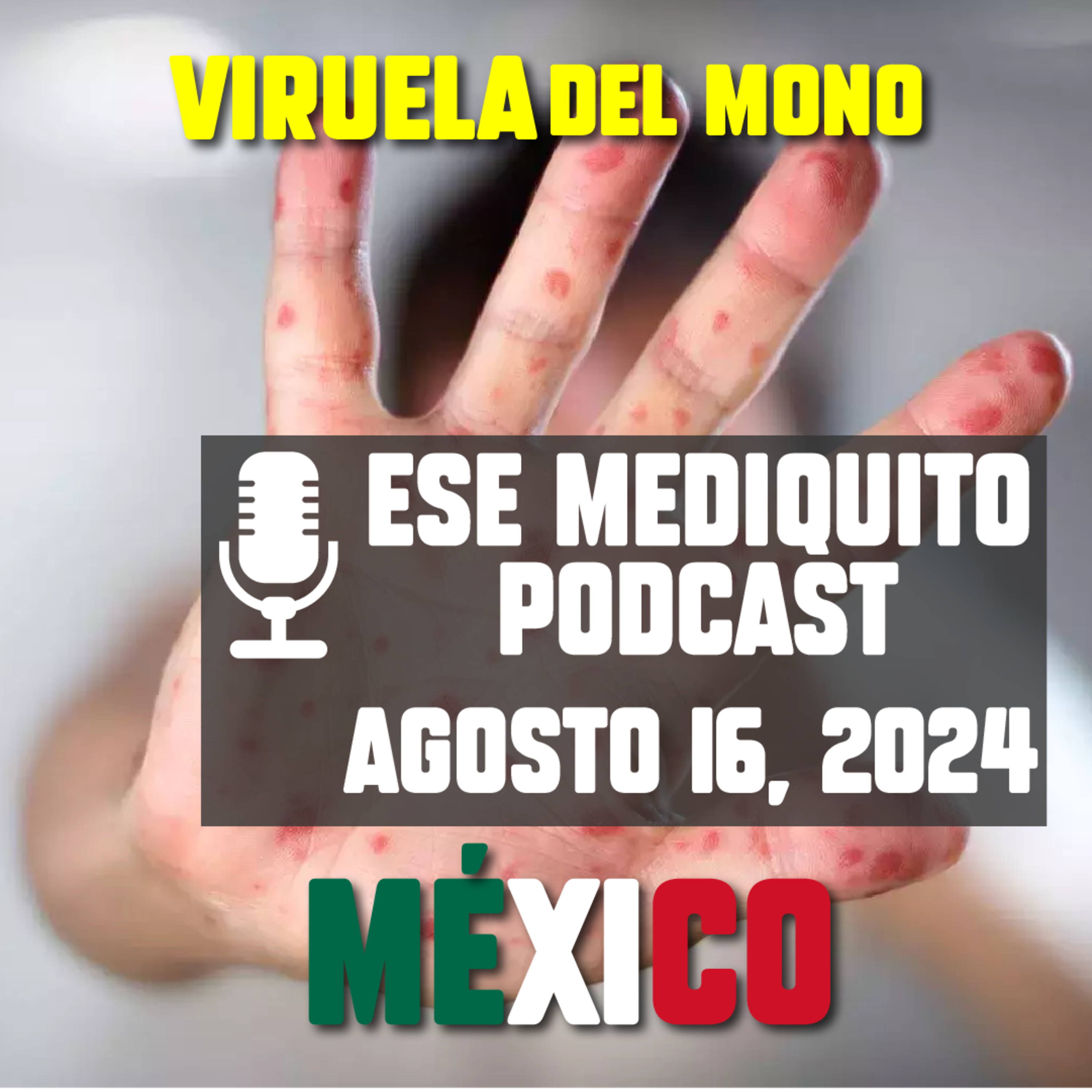 EMERGENCIA en MÉXICO: Revelan cifras OFICIALES de VIRUELA SÍMICA / VIRUELA DEL MONO #mpox 🇲🇽 | E36 episode artwork