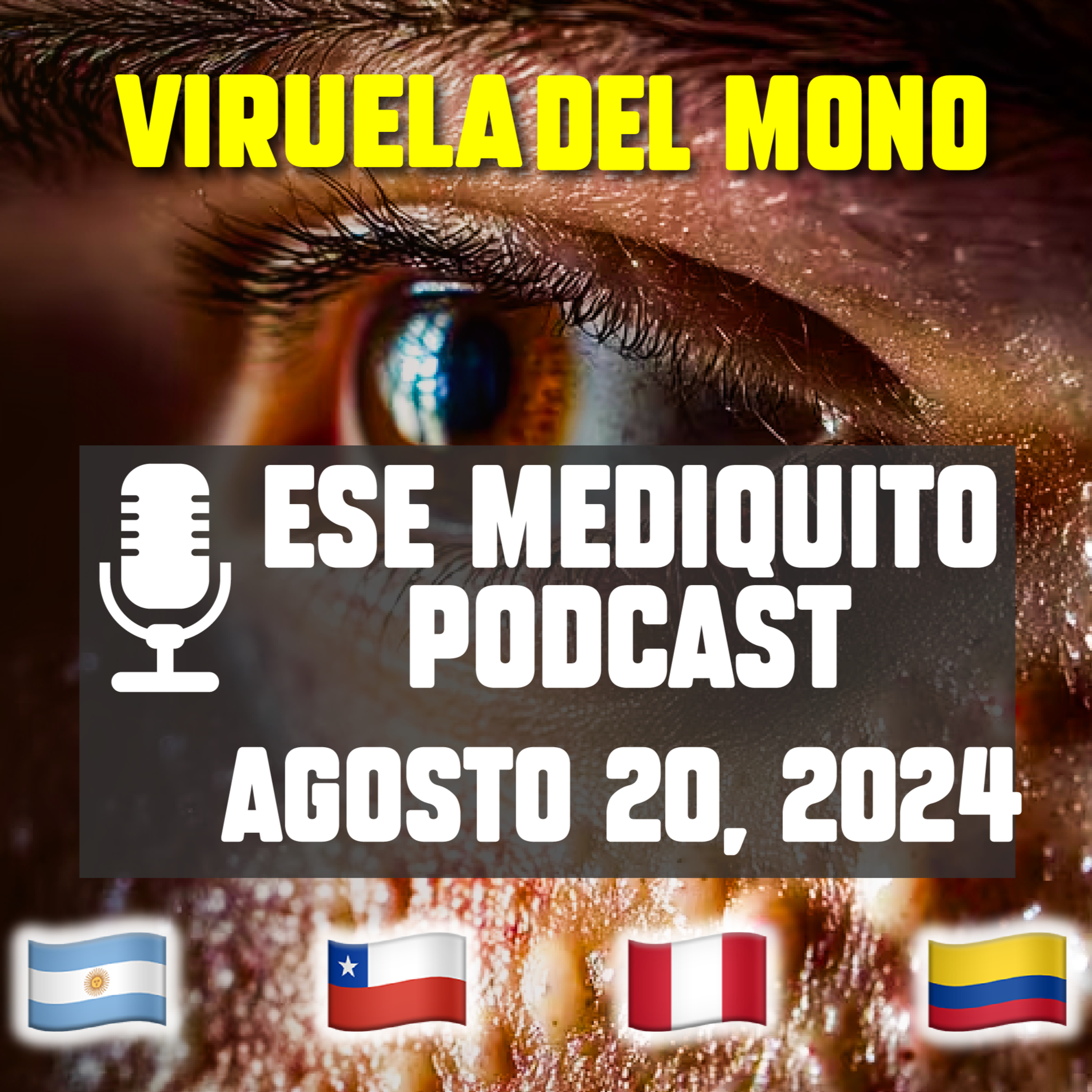 Declaran Emergencia en Colombia, Perú, Chile y Argentina por viruela del mono #mpox | E37 episode artwork
