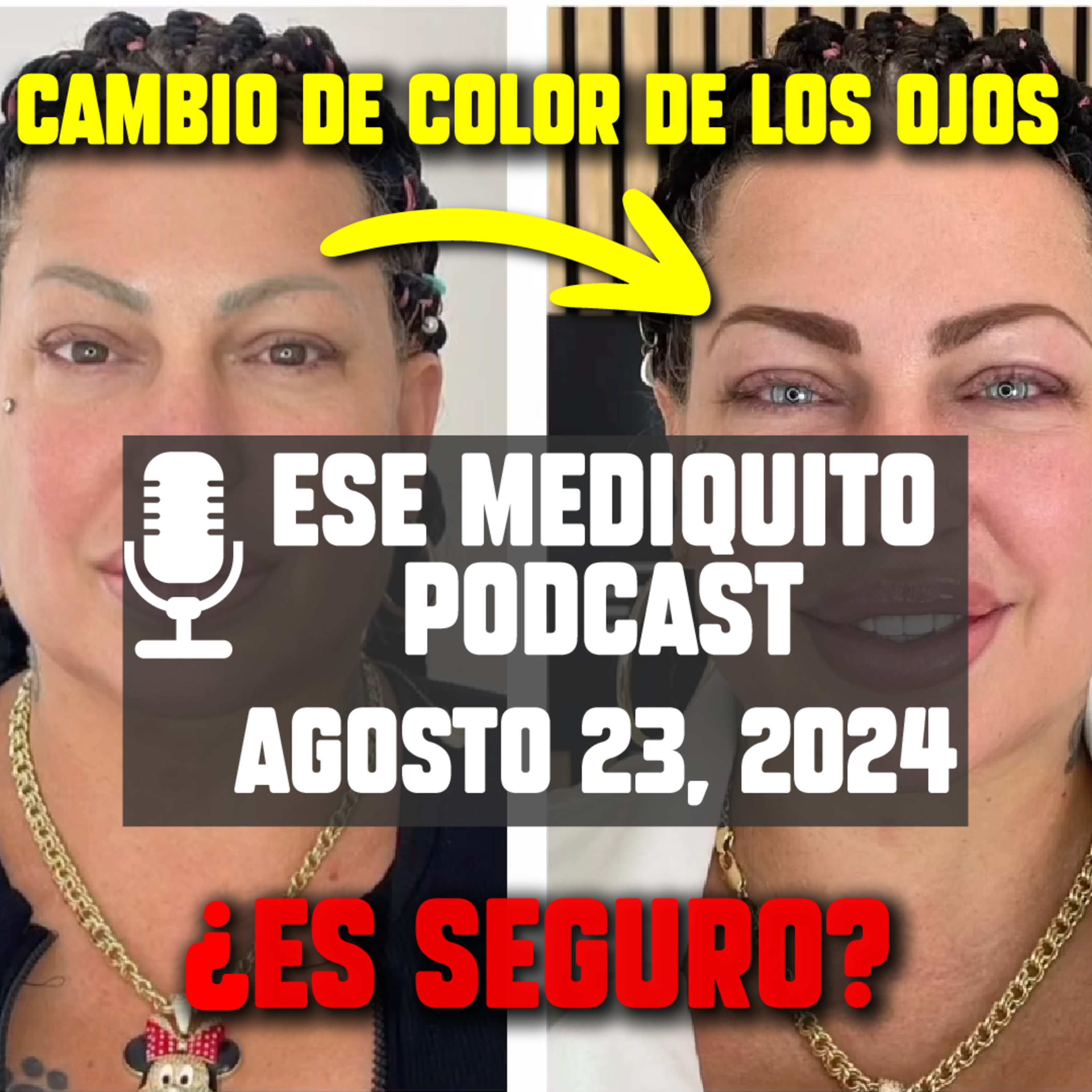Cirugía de cambio de Color de ojos - ¿Es Peligrosa? TODO lo que DEBES Saber | E38 episode artwork