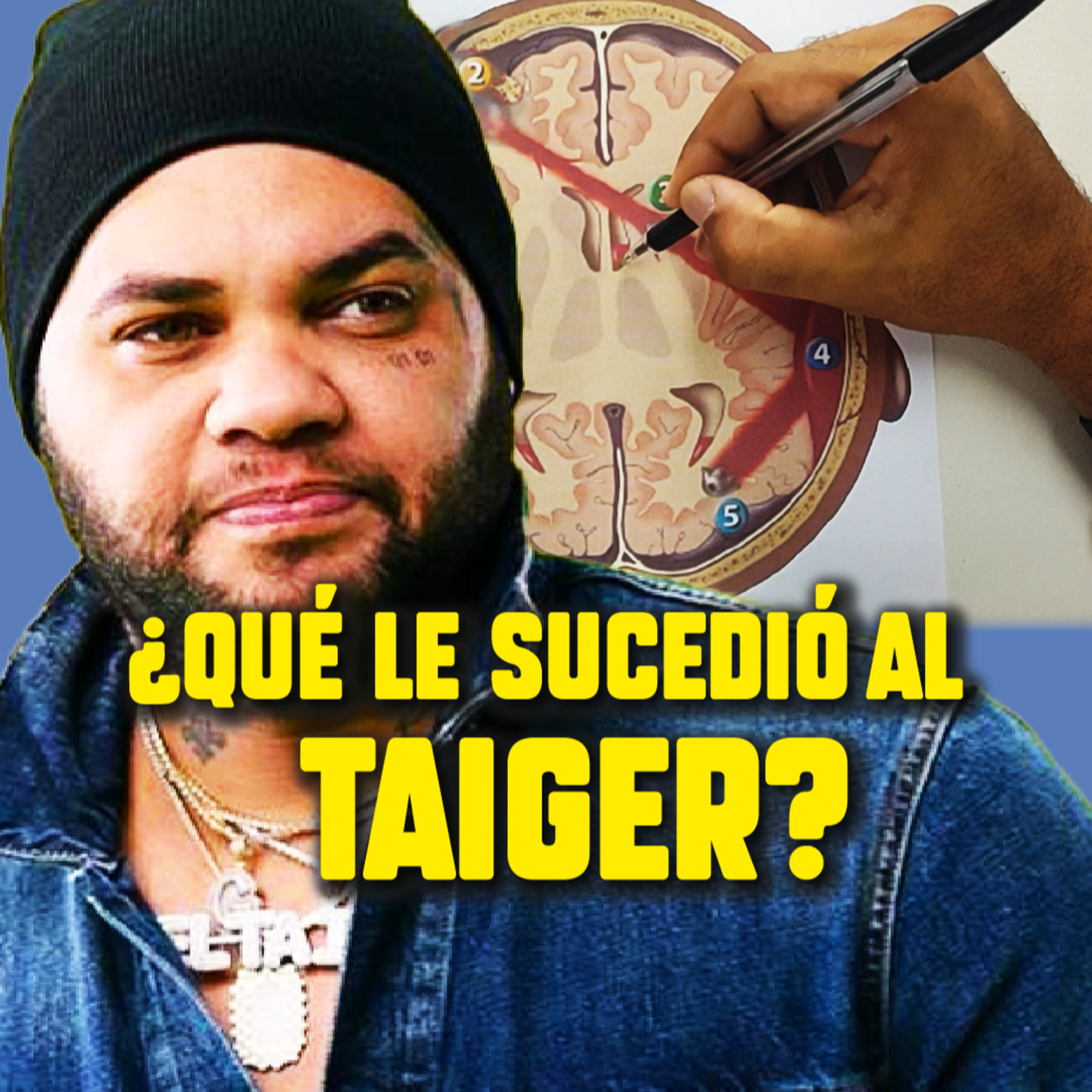 ¿Qué le pasó al TAIGER? ¿Podía sobrevivir? NEUROCIRUJANO reacciona ante el fallecimiento del Taiger episode artwork