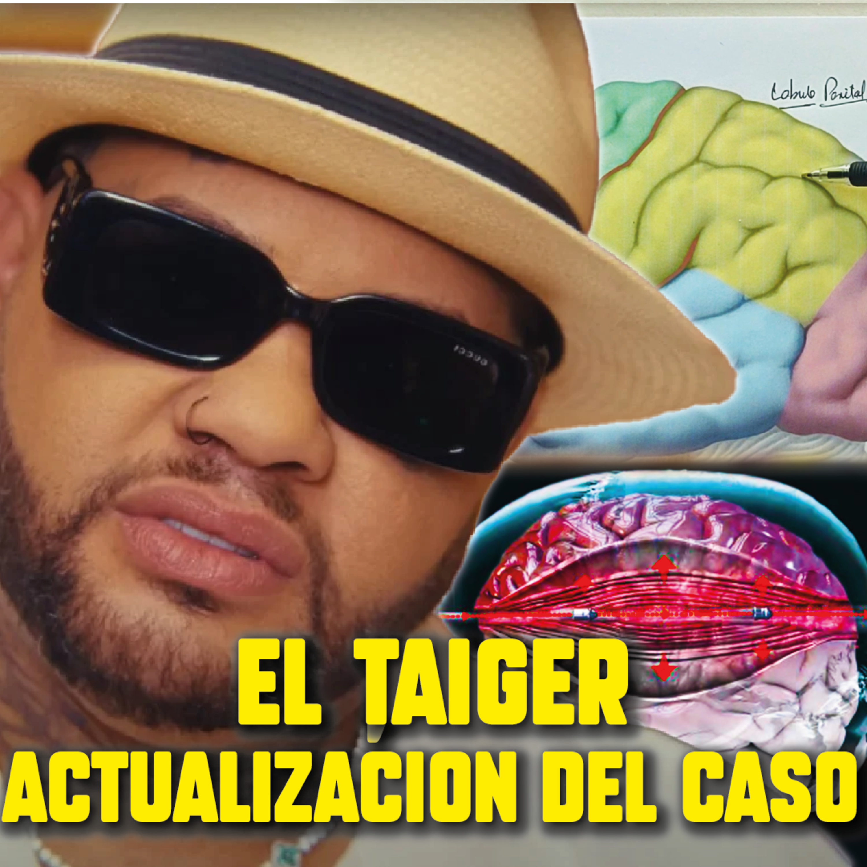 ¿Qué le pasó al TAIGER? ¿Qué secuelas tendría si sobrevivía? NEUROCIRUJANO reacciona ante El Taiger episode artwork