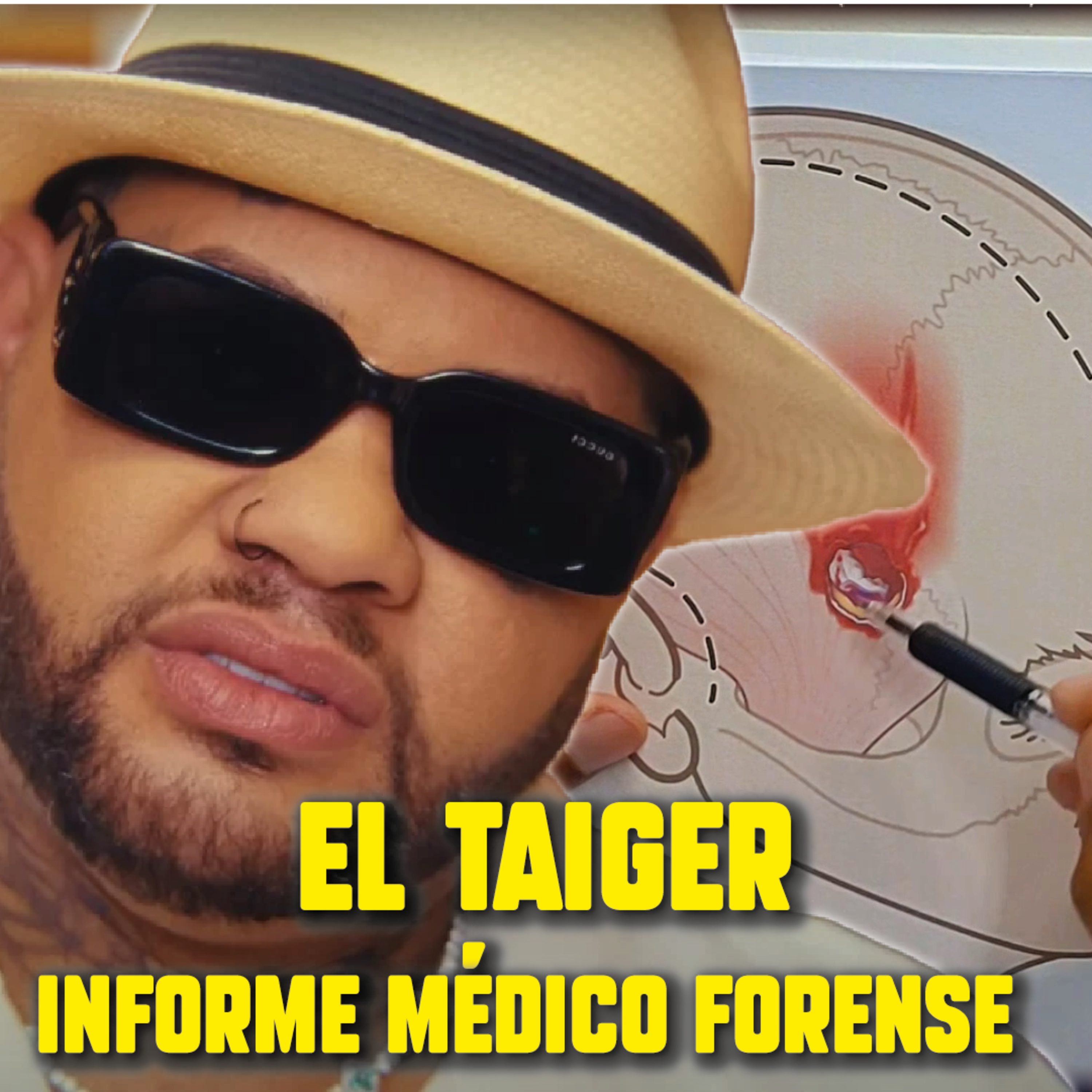 ¿Qué le pasó al TAIGER? ¿Qué complicaciones presentó? NEUROCIRUJANO reacciona al informe policial episode artwork