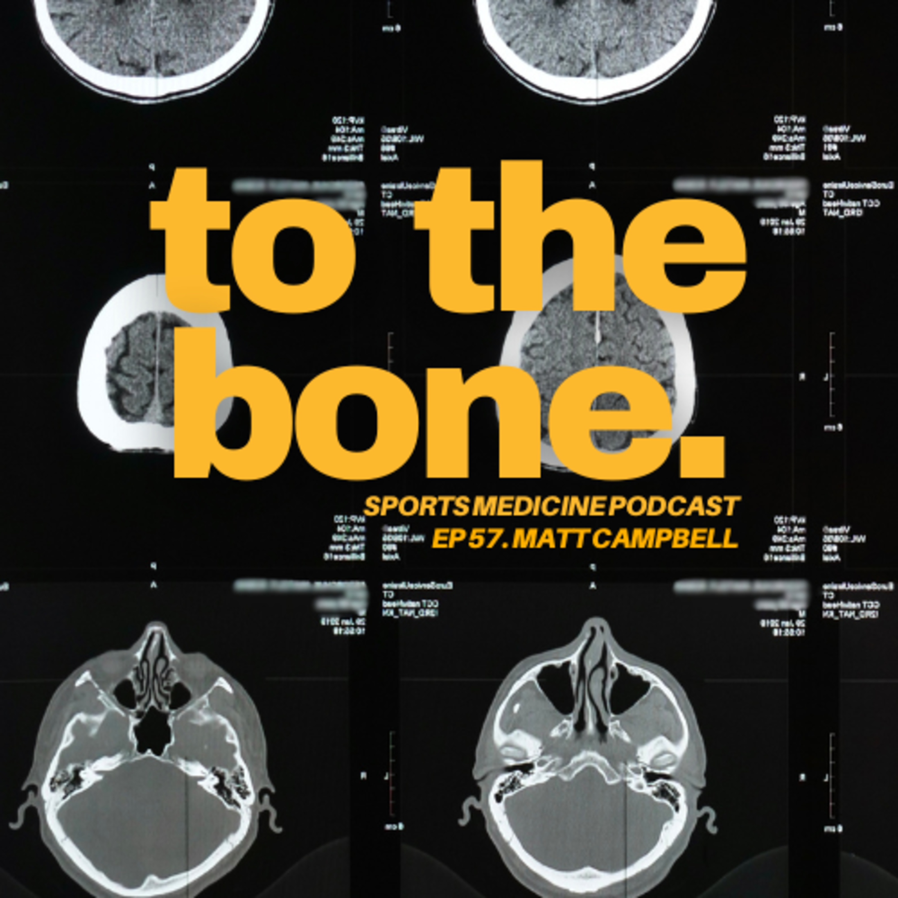 Ep 57. To The Bone: (Don't) Bang Your Head with Matt Campbell episode artwork