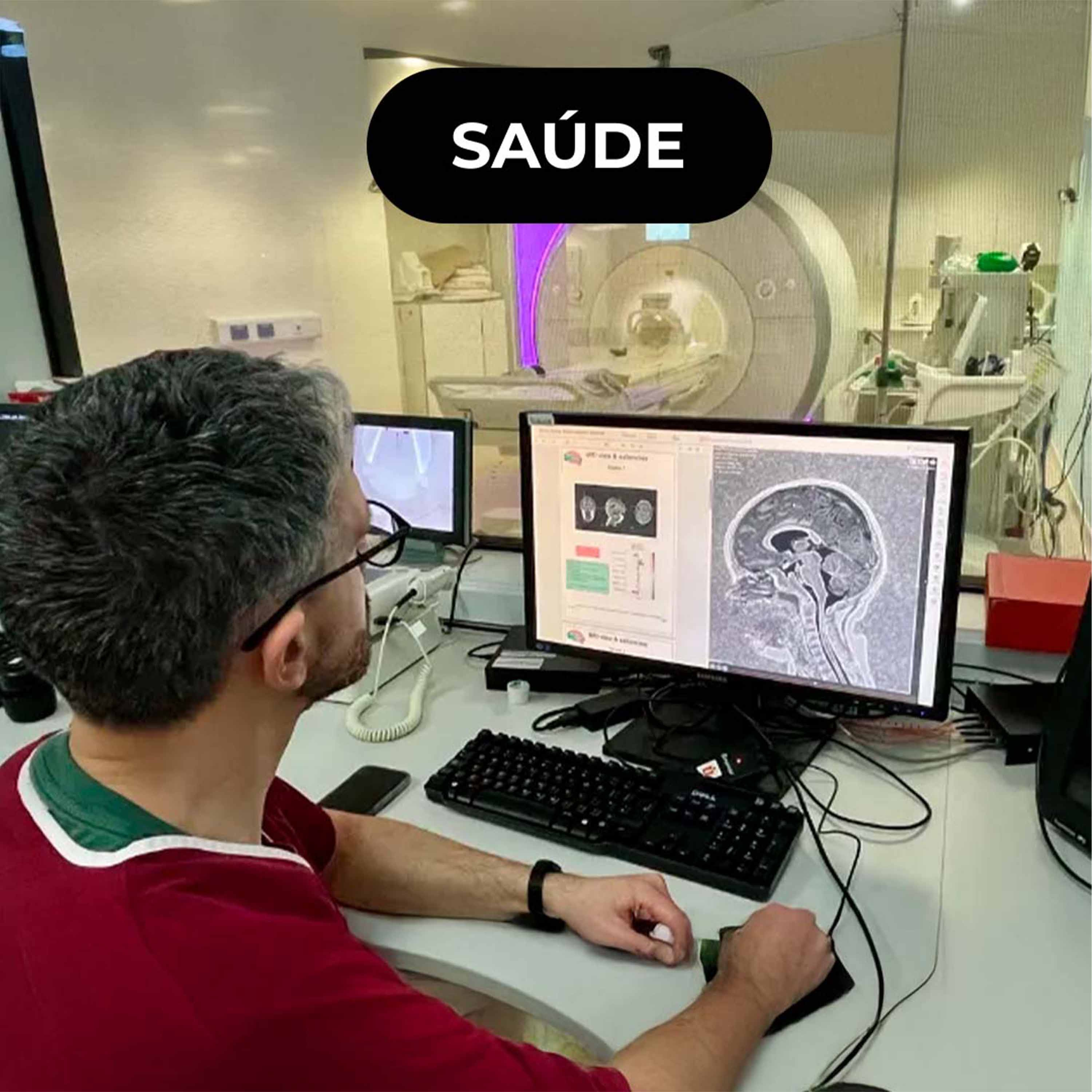 🧠 MELD Graph: uma ferramenta que identifica epilepsia com precisão