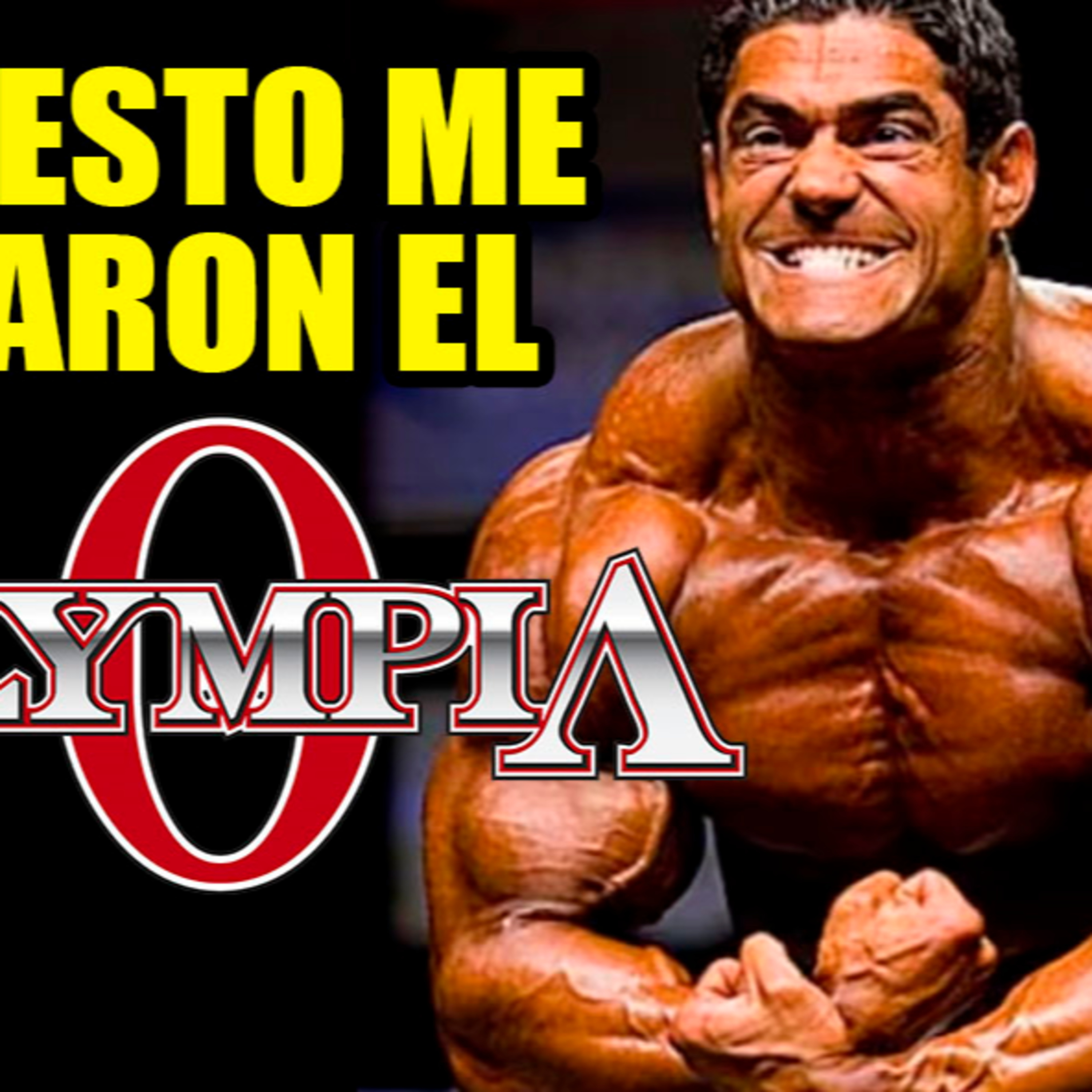 Vencí al Rey Ronnie y los que controlan el Olympia no les agradó, ya tienen a sus elegidos episode artwork