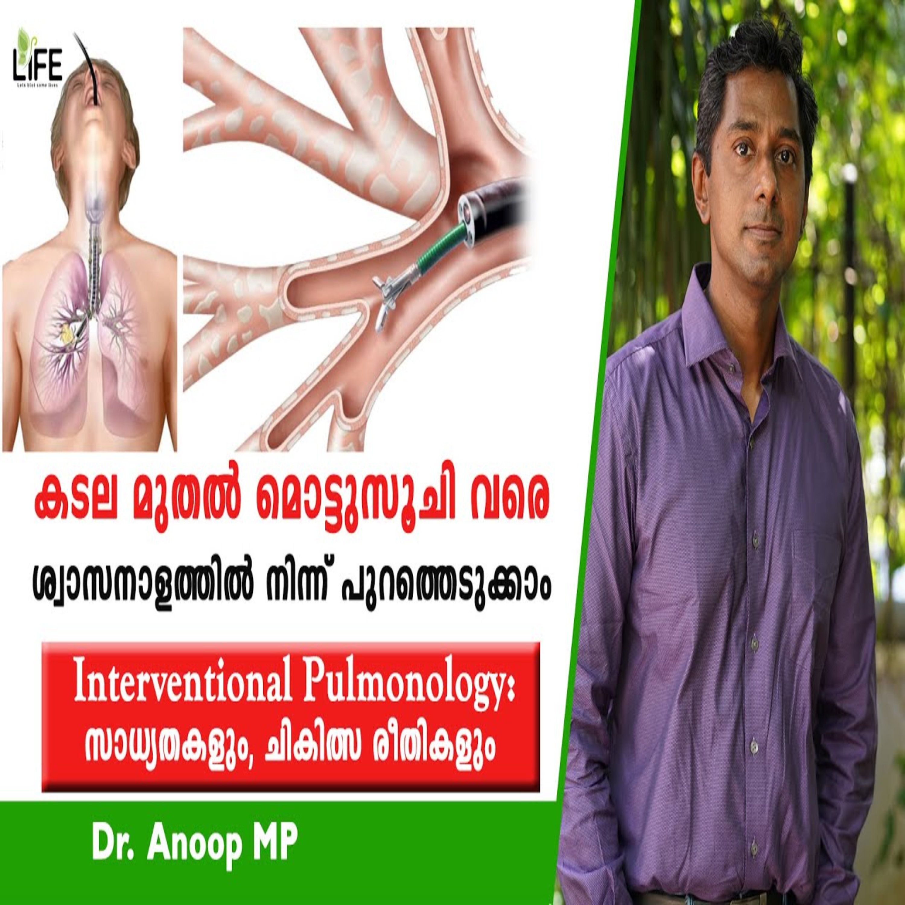 Interventional Pulmonology സാധ്യതകളും ചികിത്സ രീതികളും | Dr. Anoop MP (Senior Consultant) | Life episode artwork