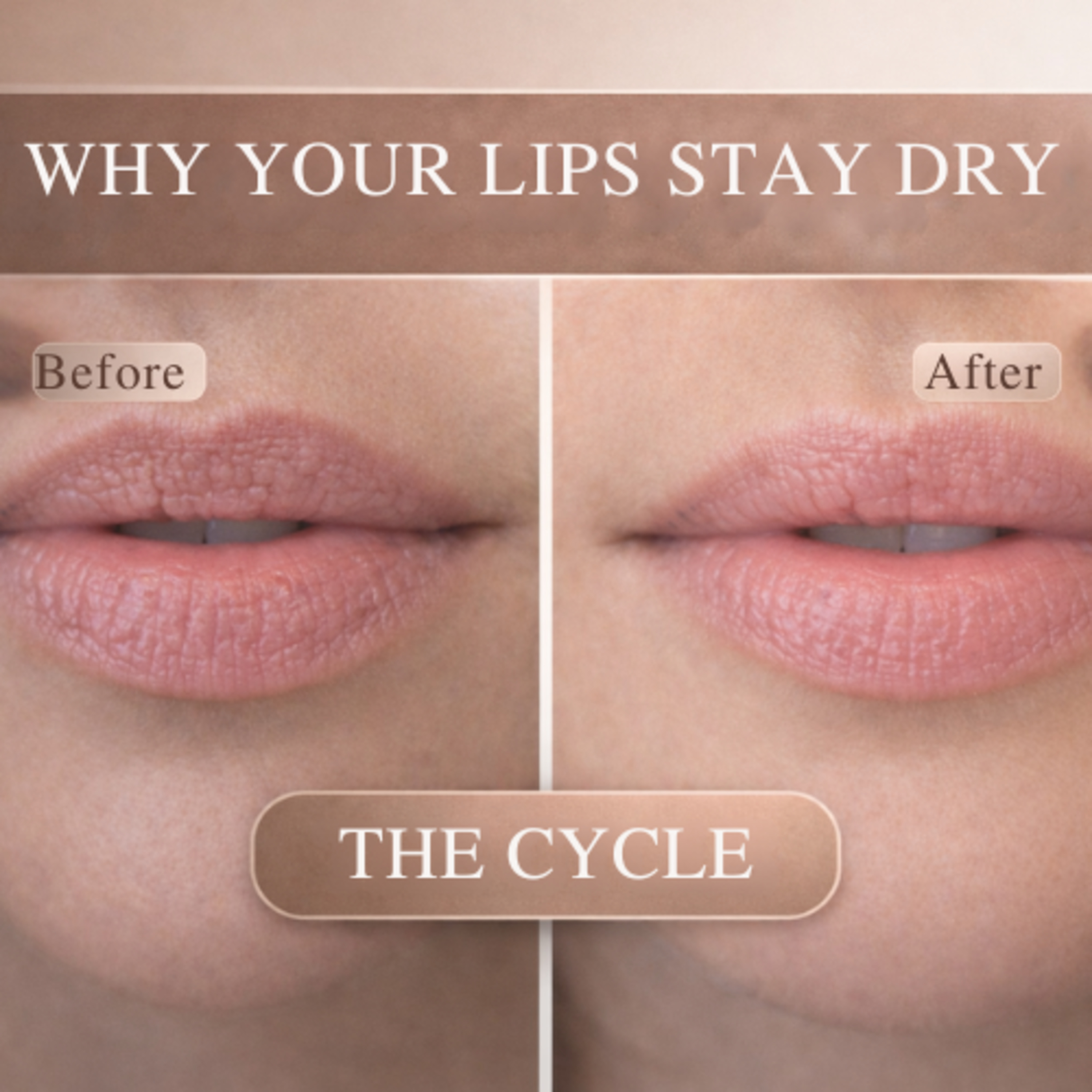 Why Your Lips Keep Getting Dry (The Dry Lip Cycle Explained) episode artwork