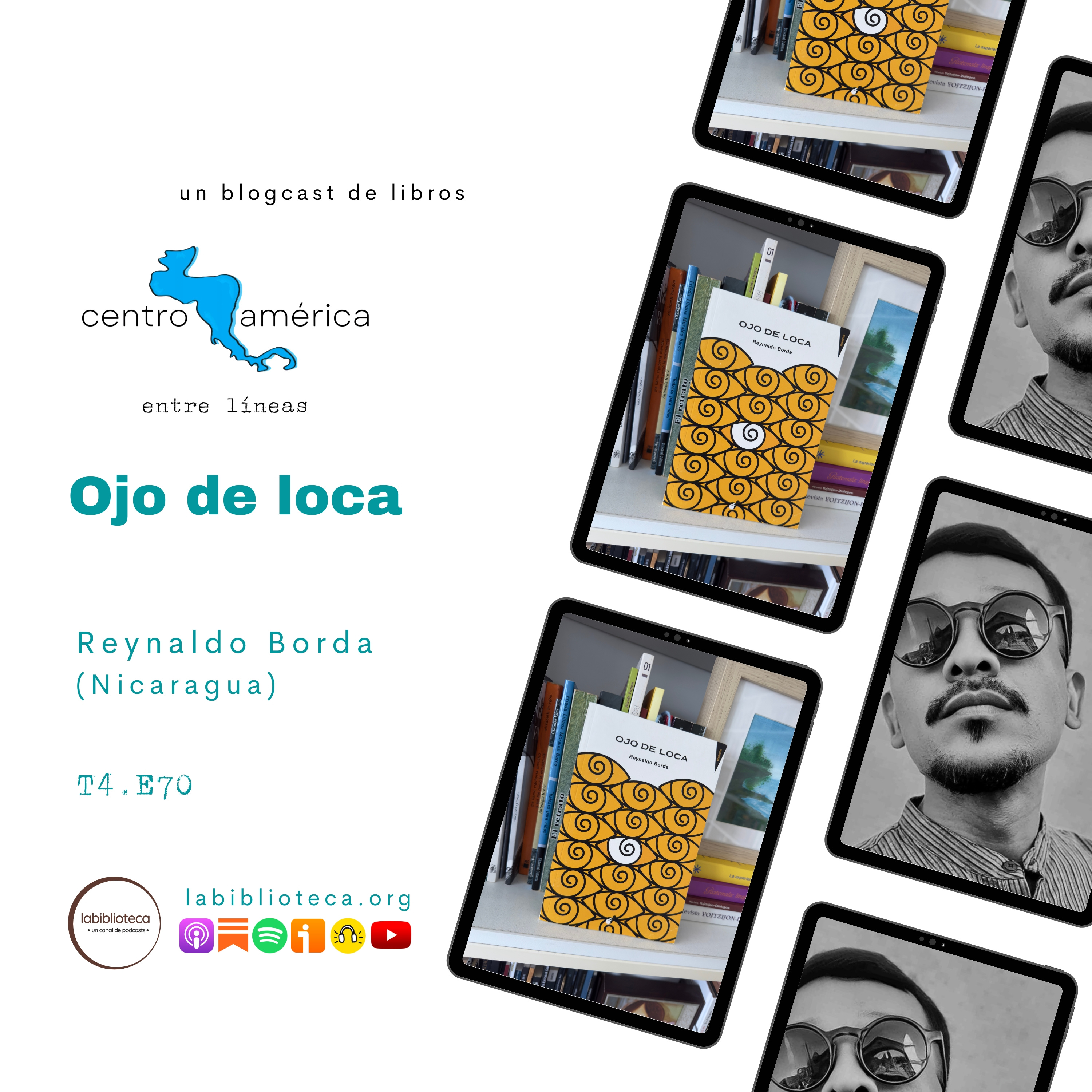 Ojo de loca de Reynaldo Borda | T5.E70