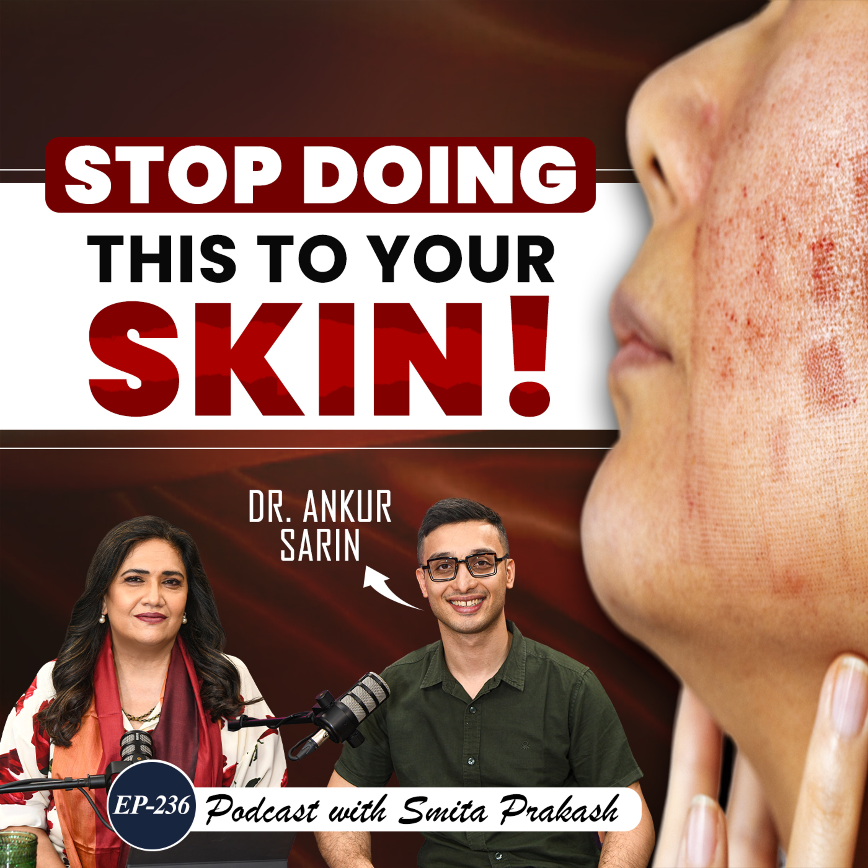 EP-236 | Acne, Pimples, Sunscreen, Hair Fall – BEST TIPS | Top Dermat Dr. Ankur Sarin