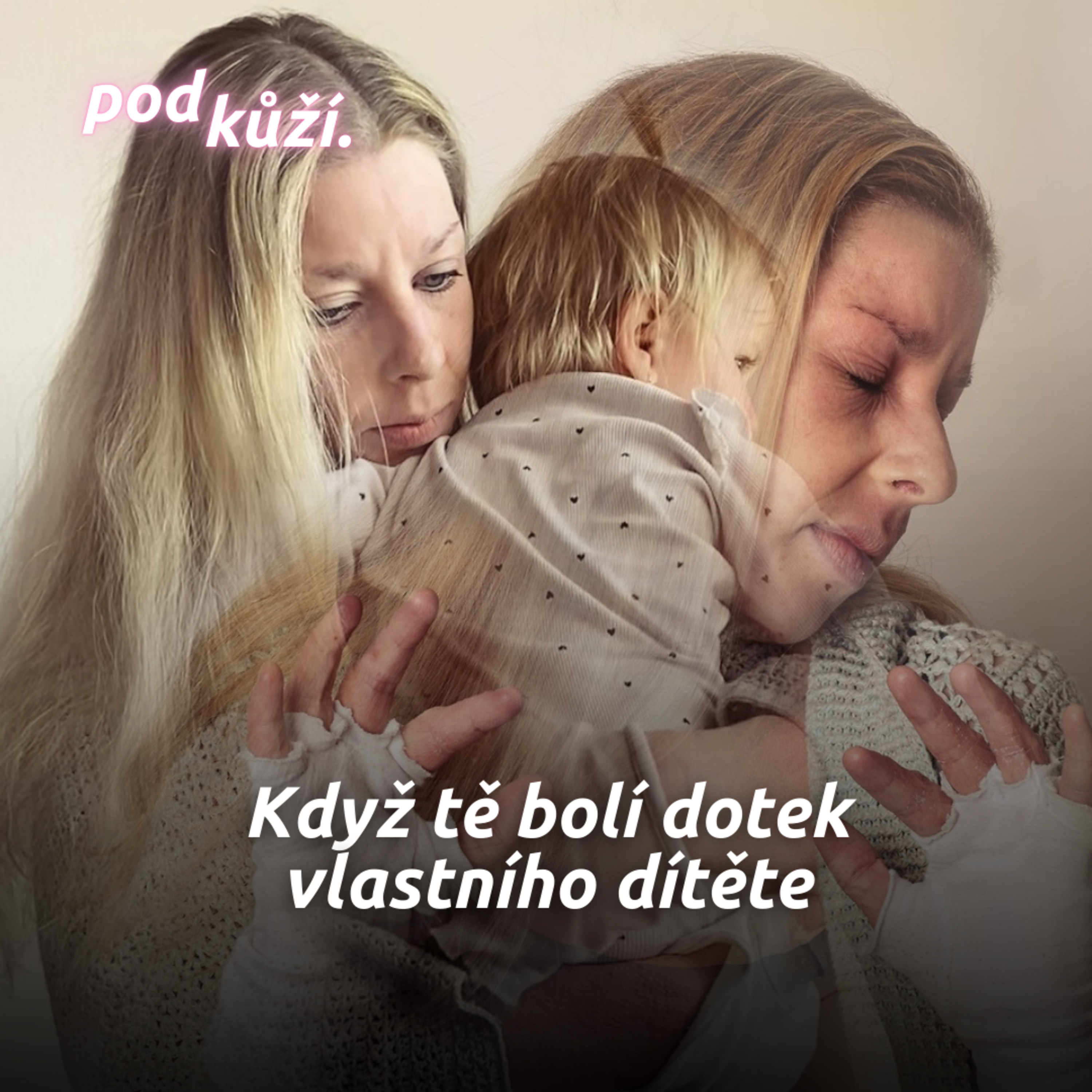 Jana: Když jsem měla ekzém, nechtěla jsem se dotknout svého dítěte episode artwork