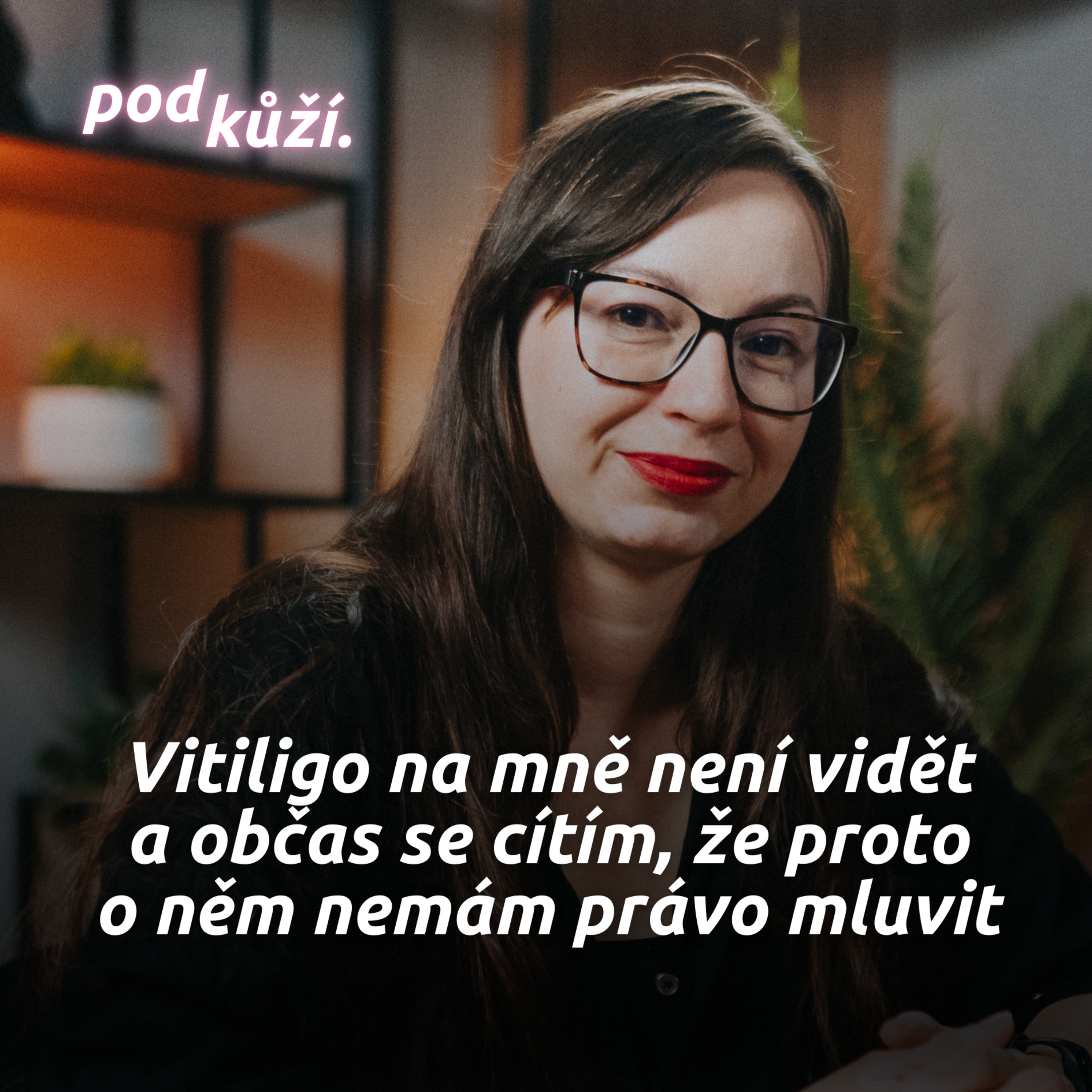 Monika z Vitiligo klub: "Nedokonalost" na tobě musí být pořádně vidět, jinak lidi nezajímáš episode artwork