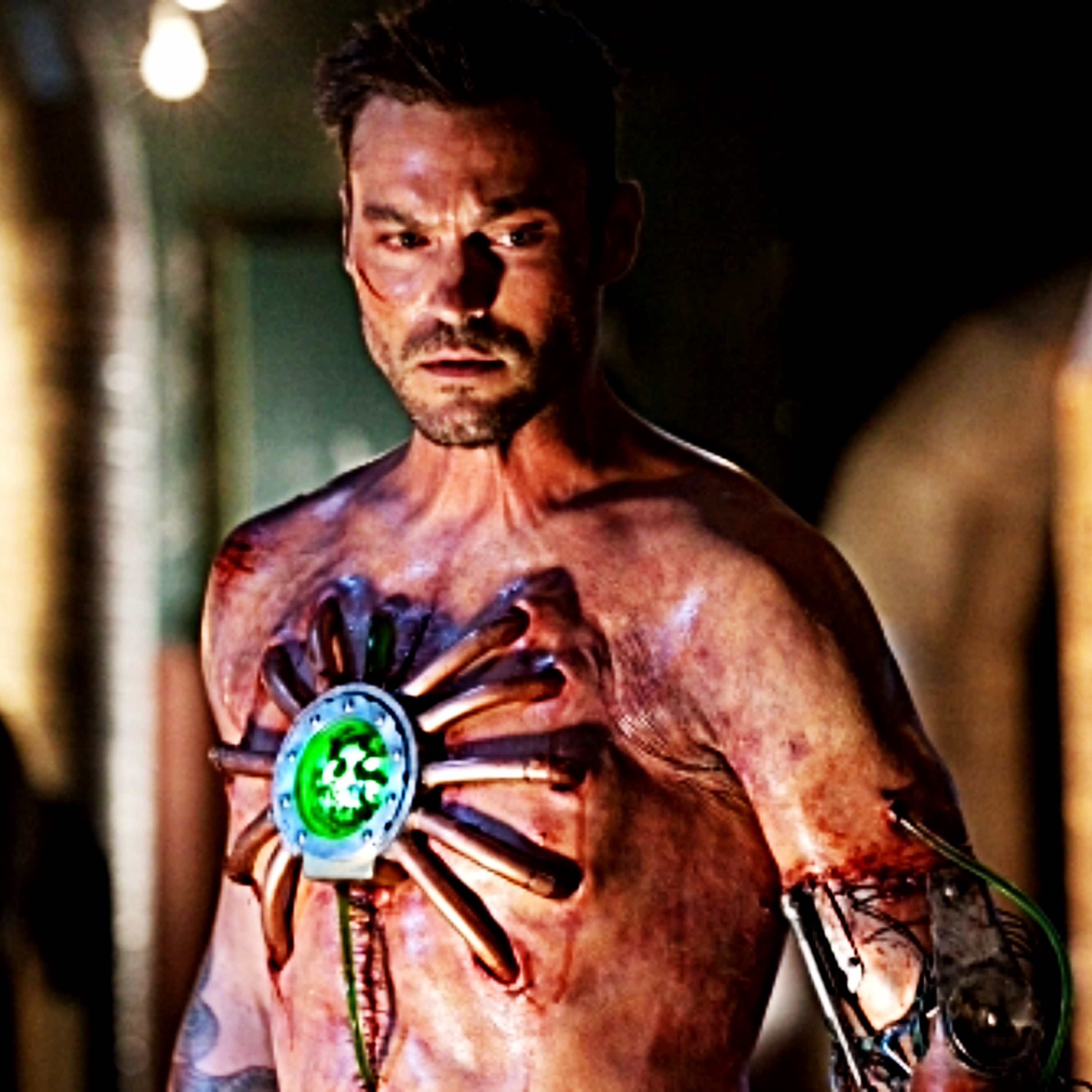 #9.2 - Metallo