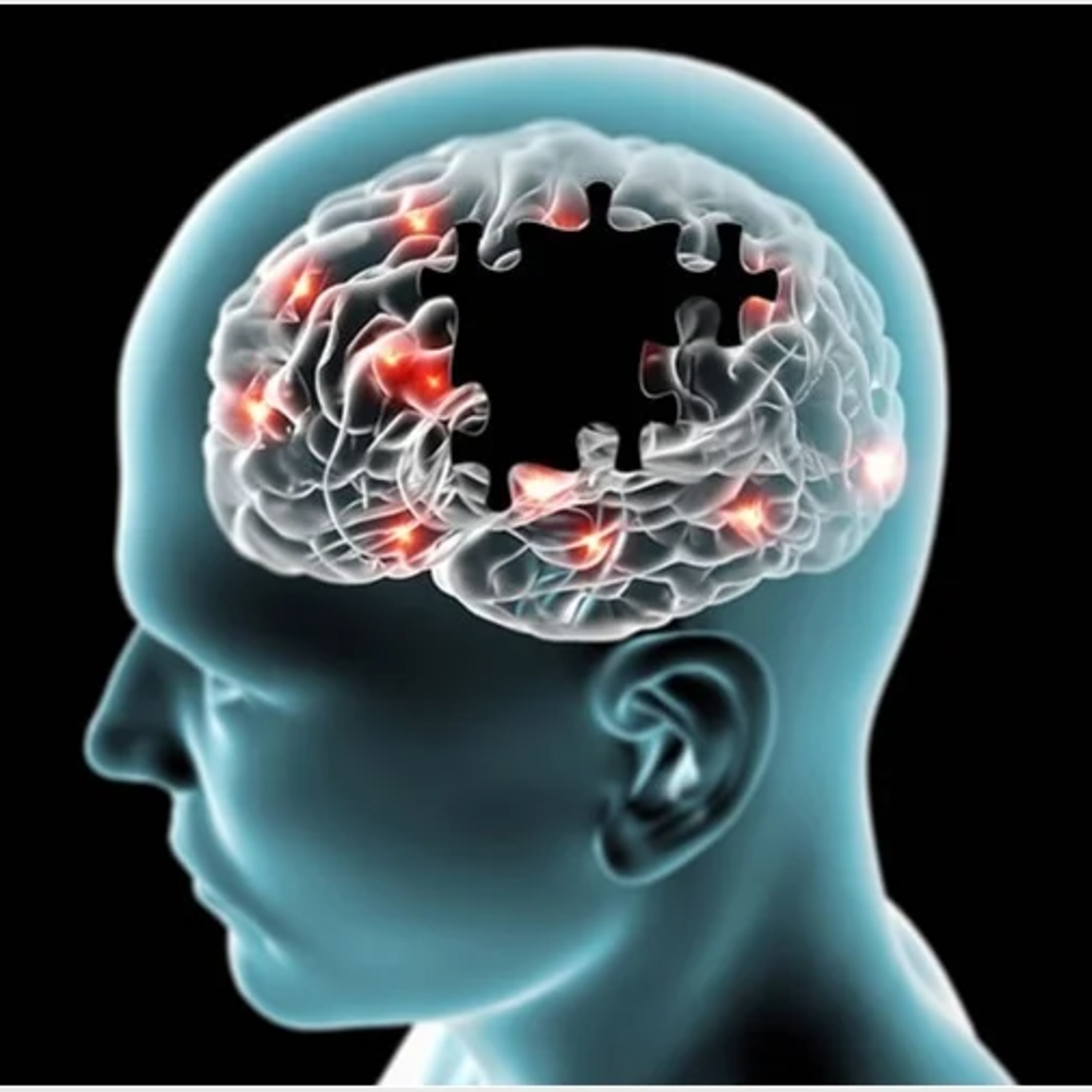 Biotech startup fighting Alzheimer's Disease episode artwork