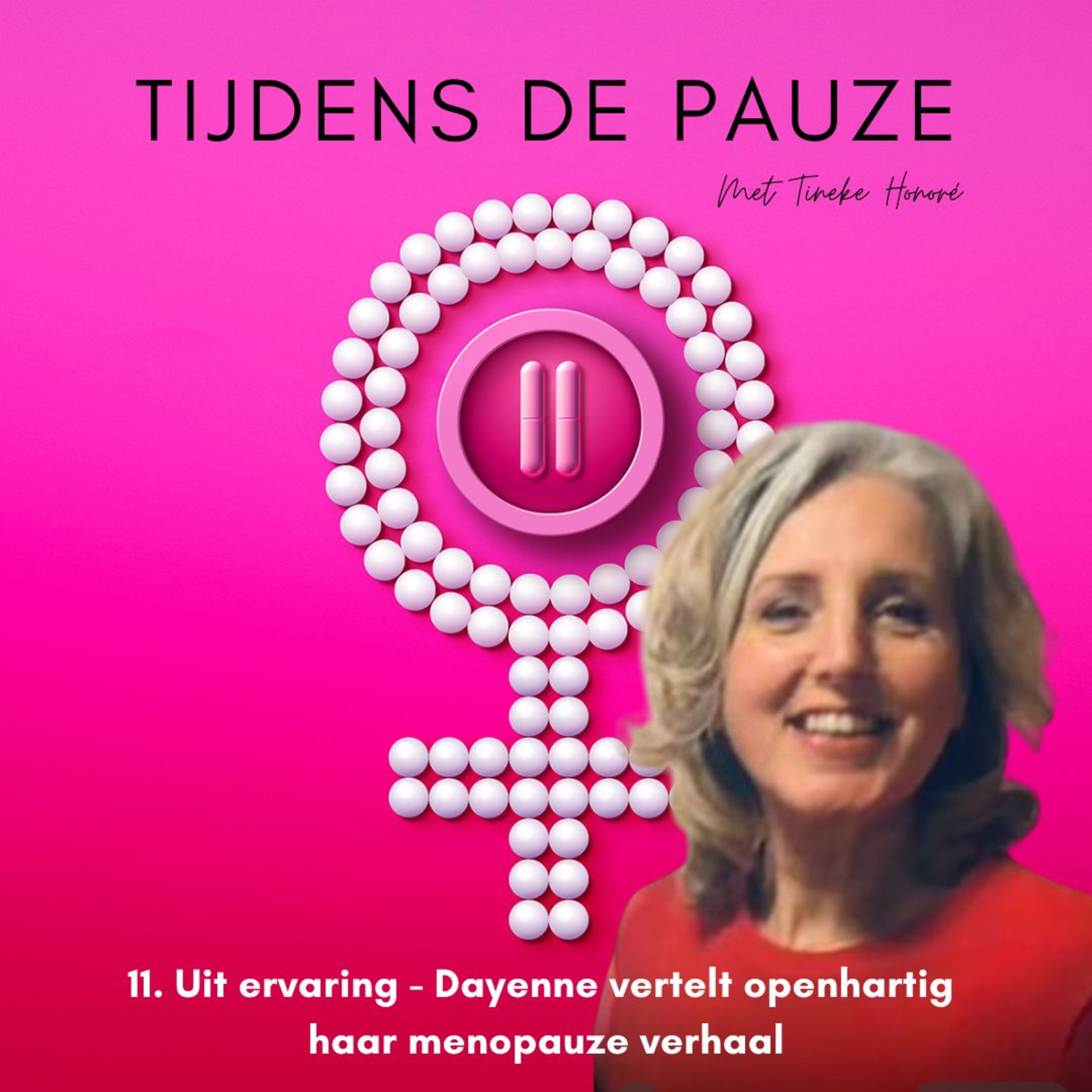 Tijdens de Pauze - De podcast die je alles vertelt over perimenopauze en menopauze