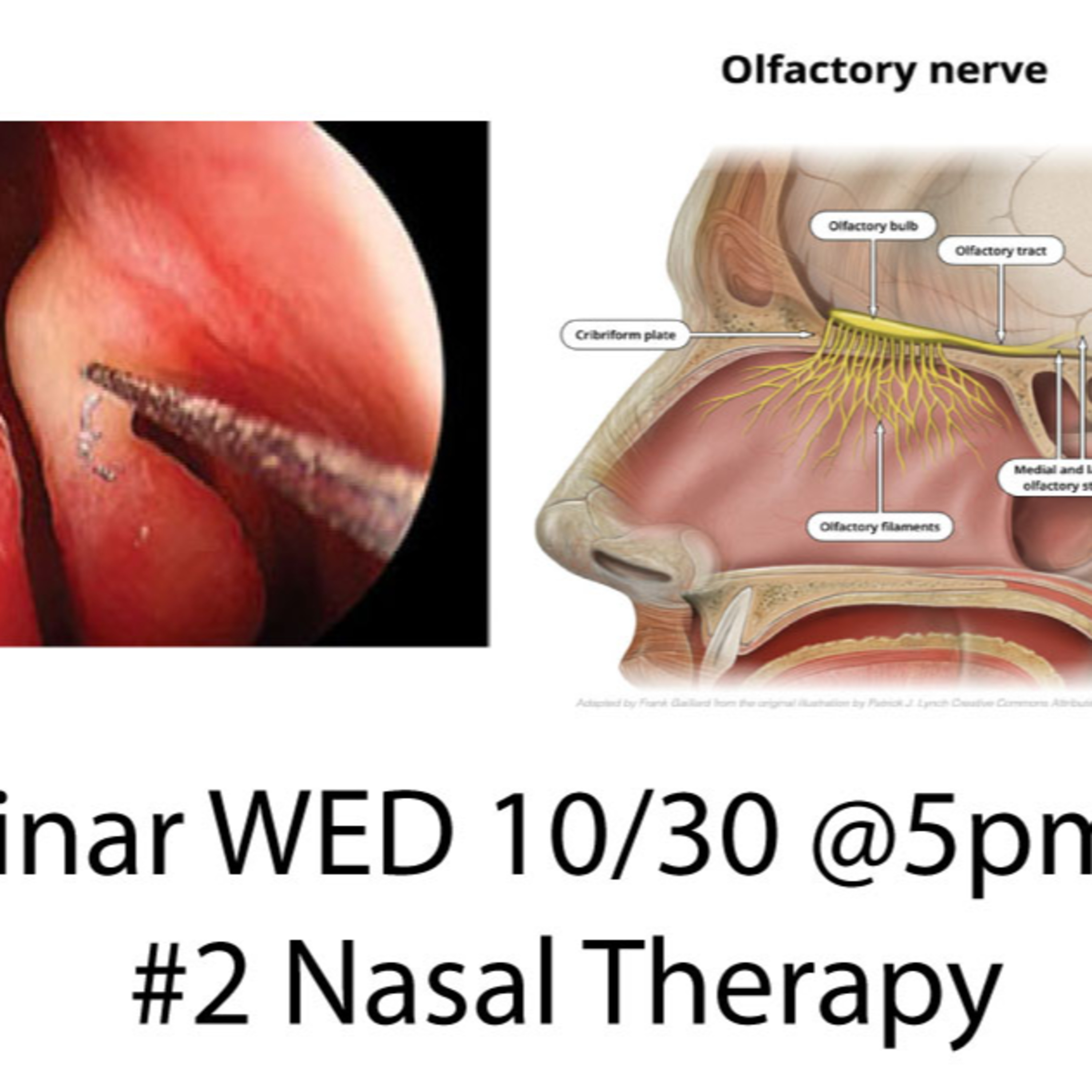 Provider Webinar #2 - Nasal Treatments