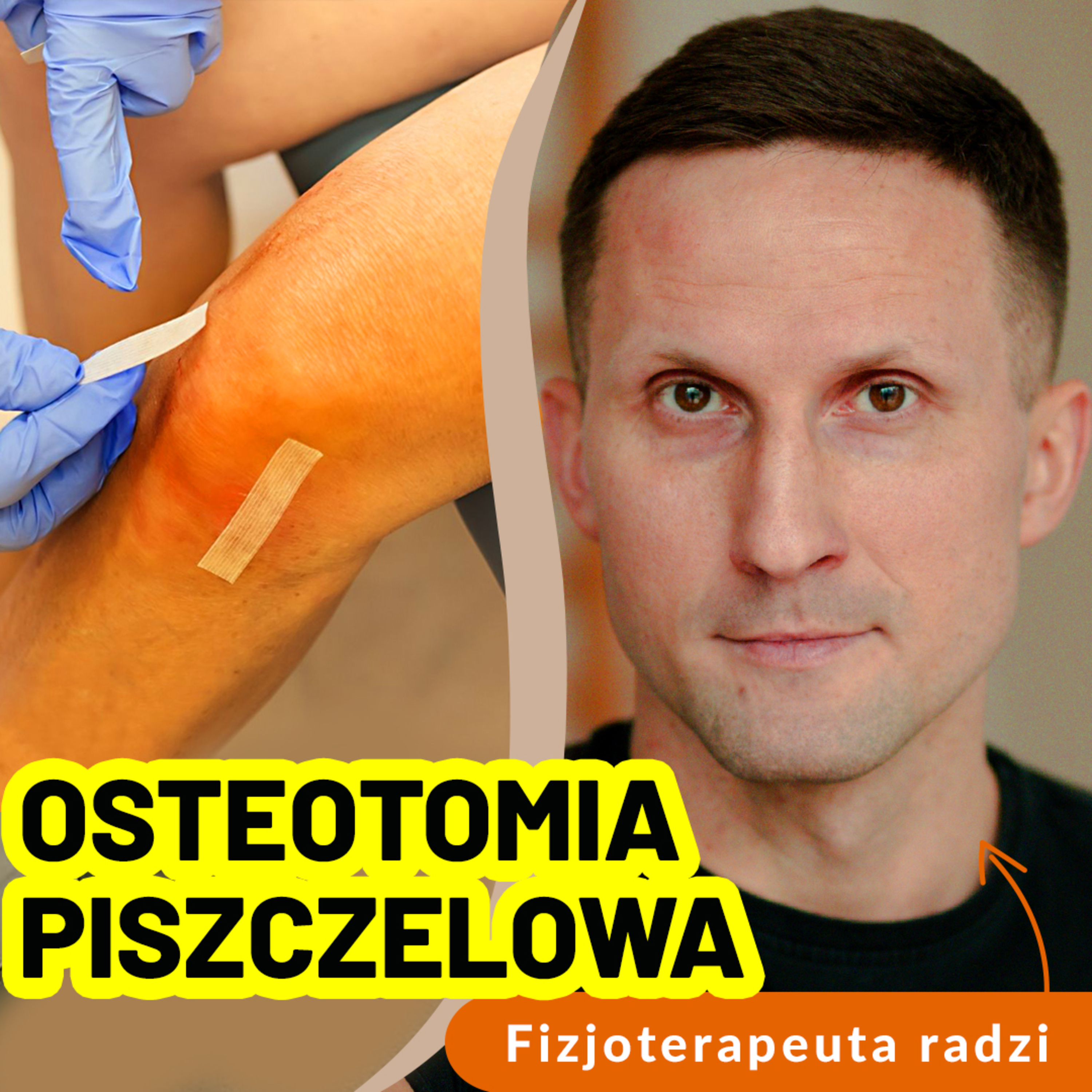 Osteotomia piszczelowa – kiedy warto ją rozważyć i co trzeba wiedzieć przed operacją? episode artwork