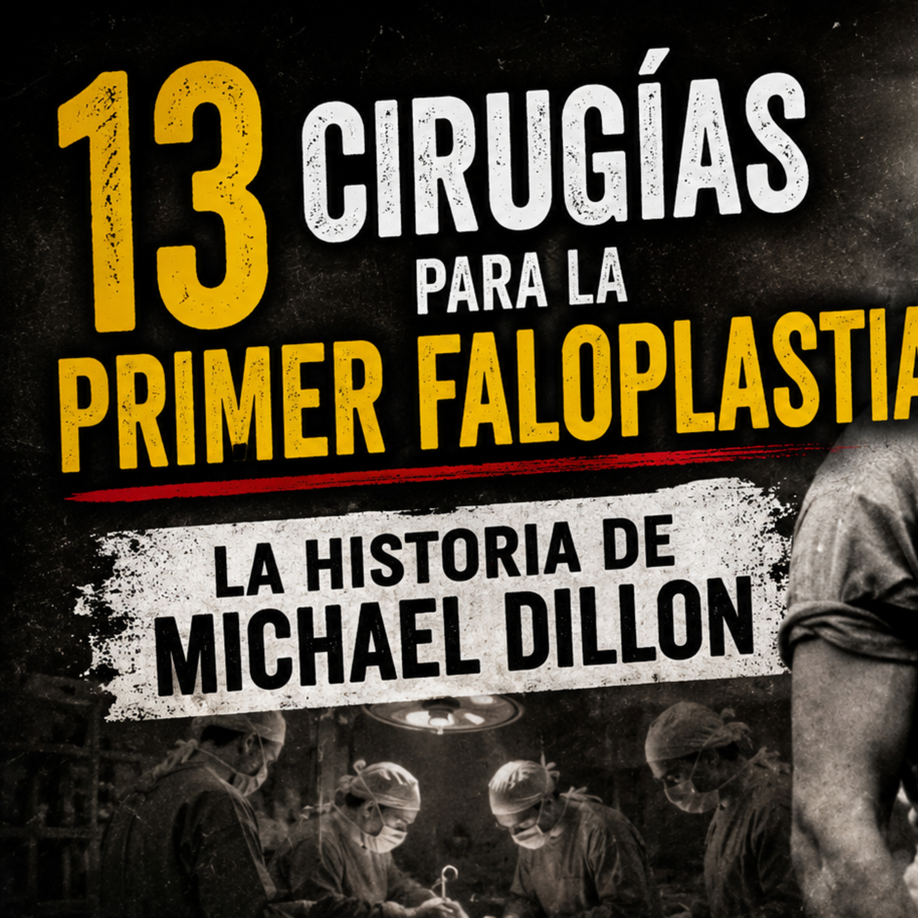 13 cirugías para la primer faloplastia | La historia de Michael Dillon episode artwork