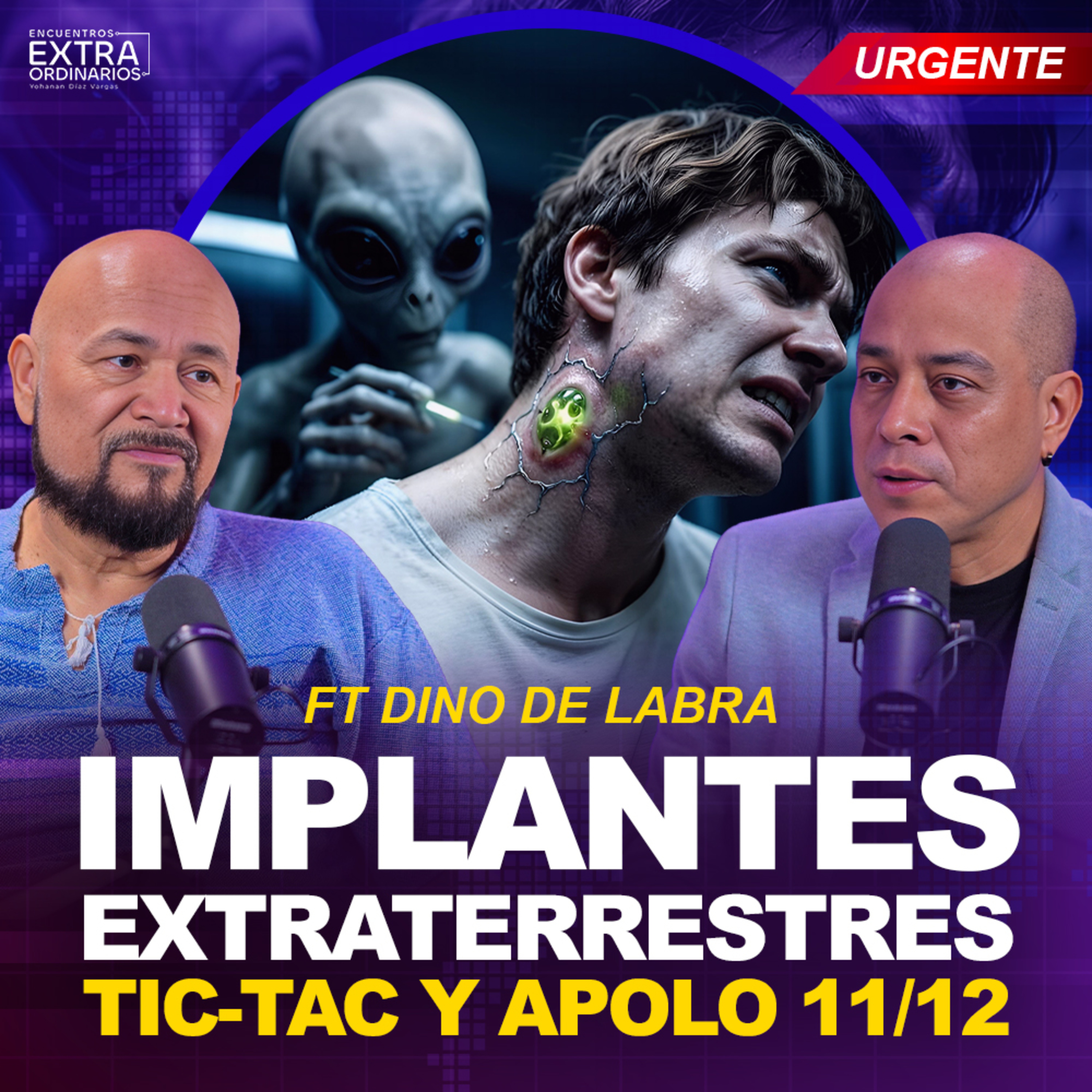 Implantes e Implantes: Tic-Tac, Apolo y Desclasificación OVNI | Dino de Labra